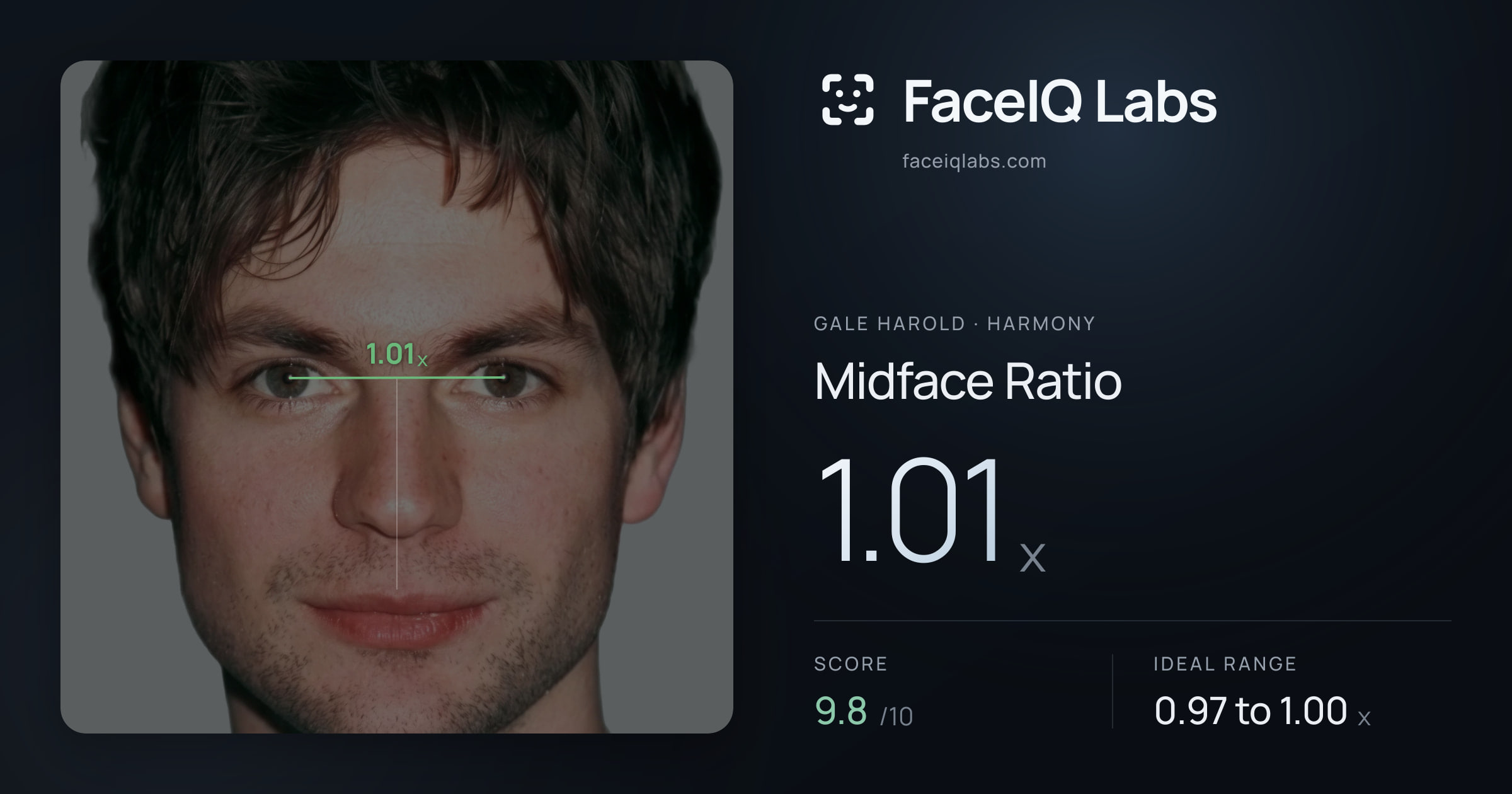 Gale Harold Midface Ratio: 1.01x, drawn on the photo