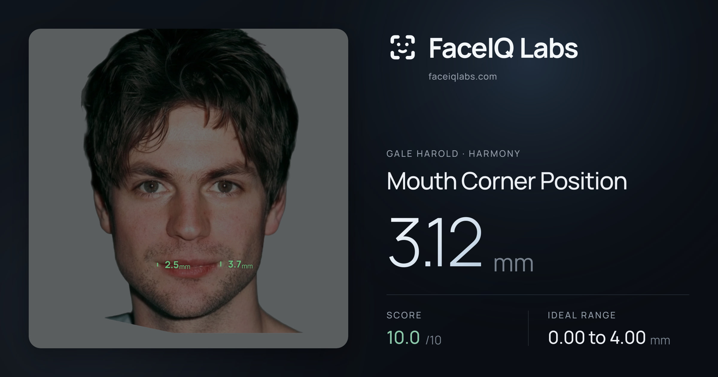 Gale Harold Mouth Corner Position: 3.12mm, drawn on the photo
