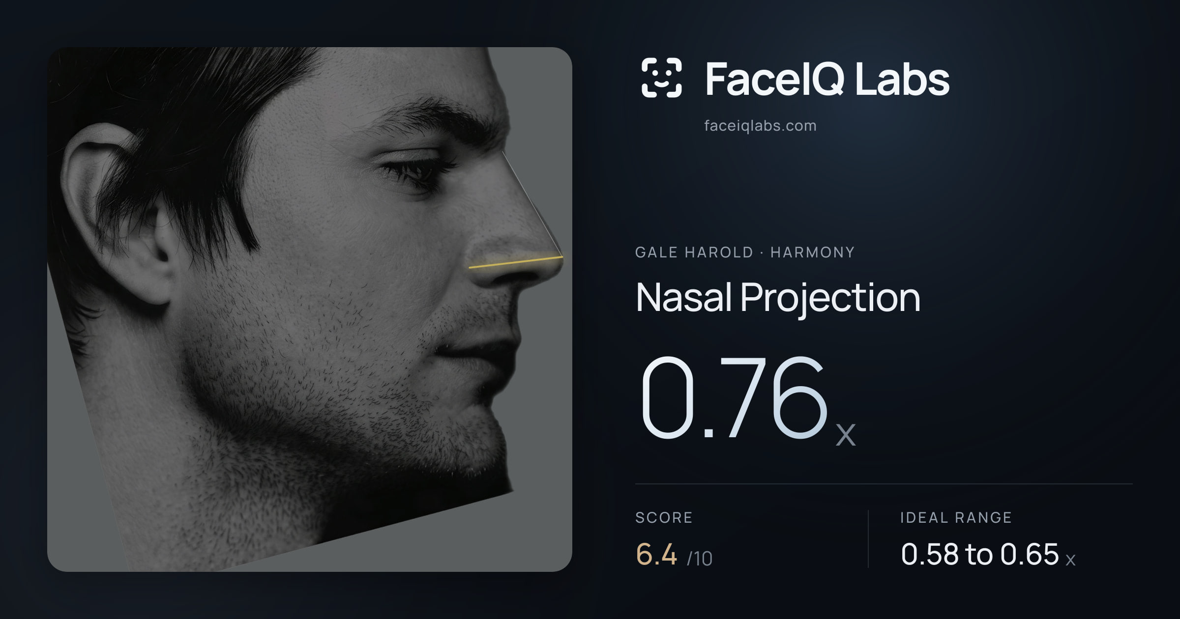 Gale Harold Nasal Projection: 0.76x, drawn on the photo