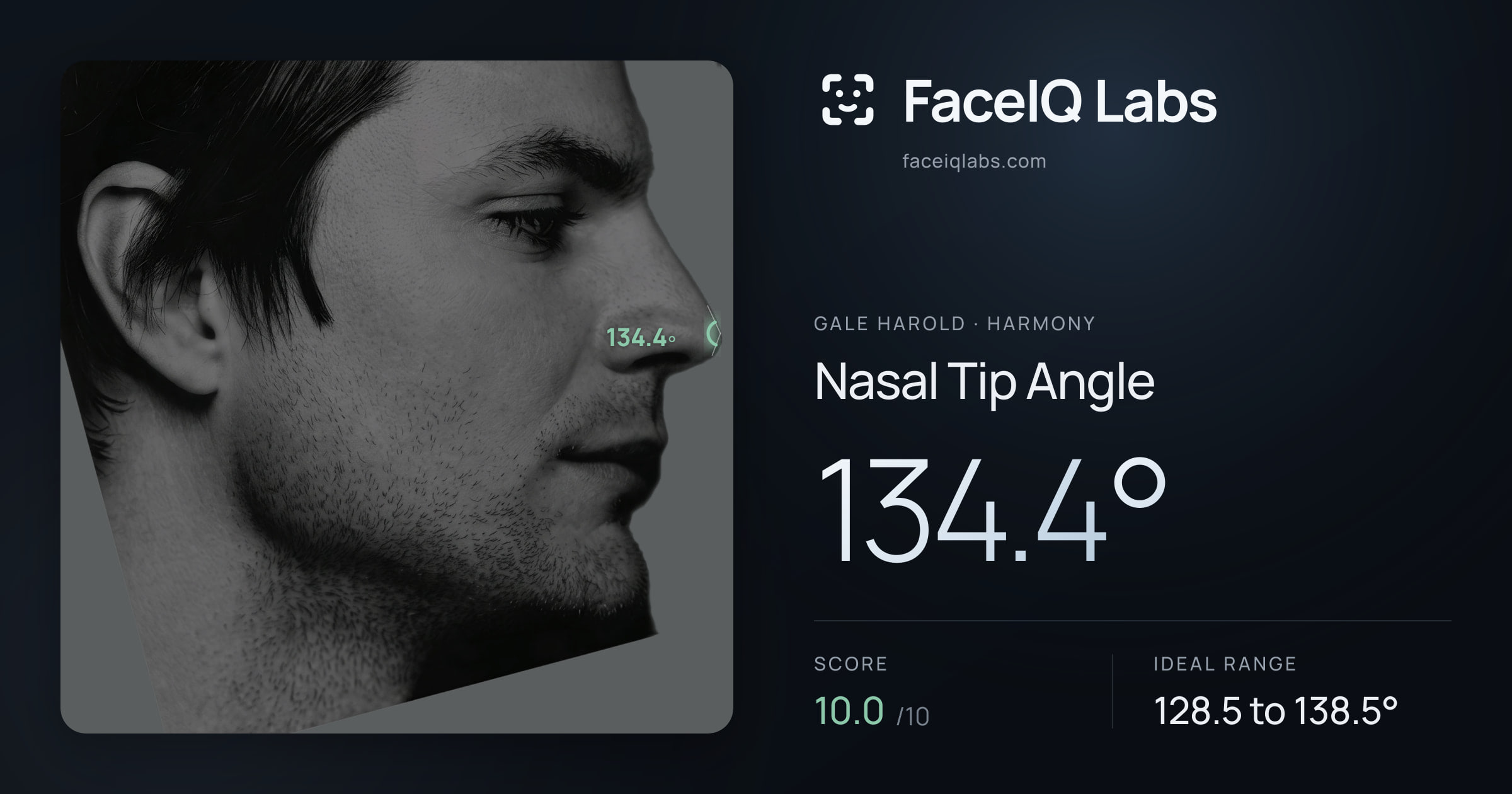 Gale Harold Nasal Tip Angle: 134.4°, drawn on the photo