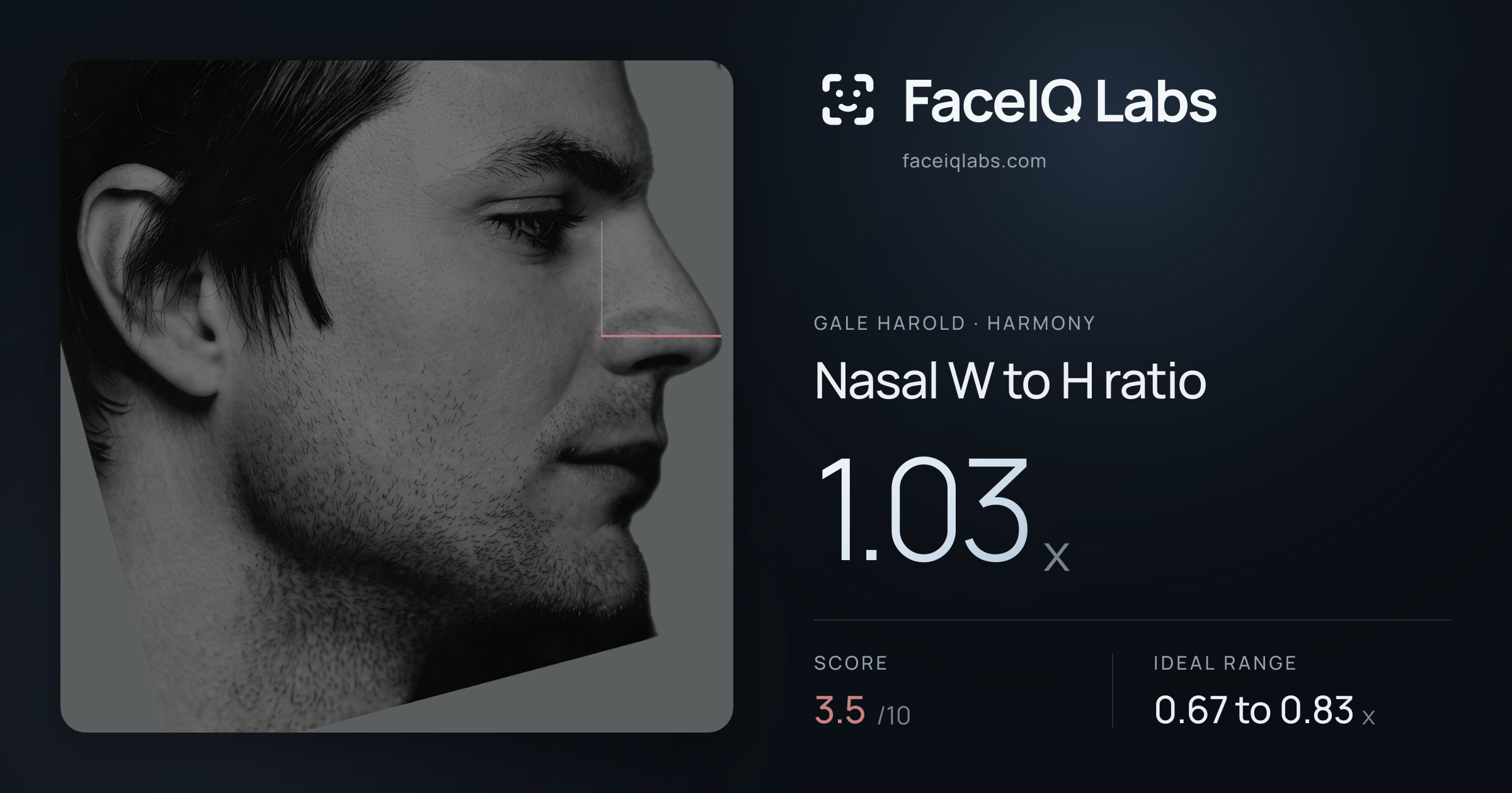 Gale Harold Nasal W to H ratio: 1.03x, drawn on the photo