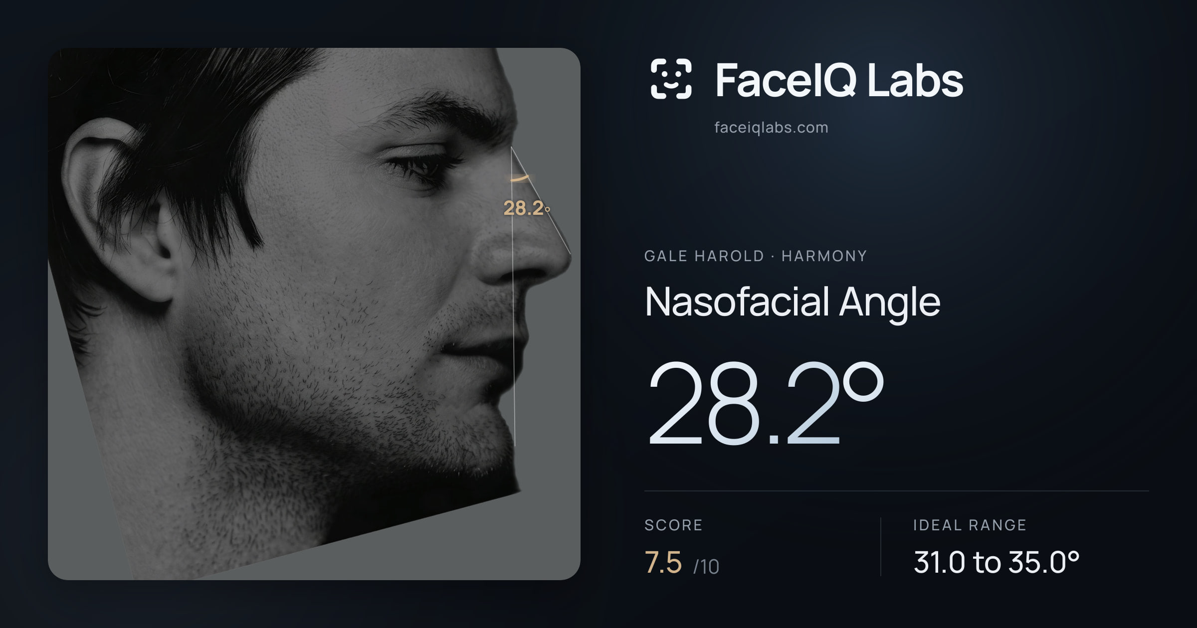Gale Harold Nasofacial Angle: 28.2°, drawn on the photo