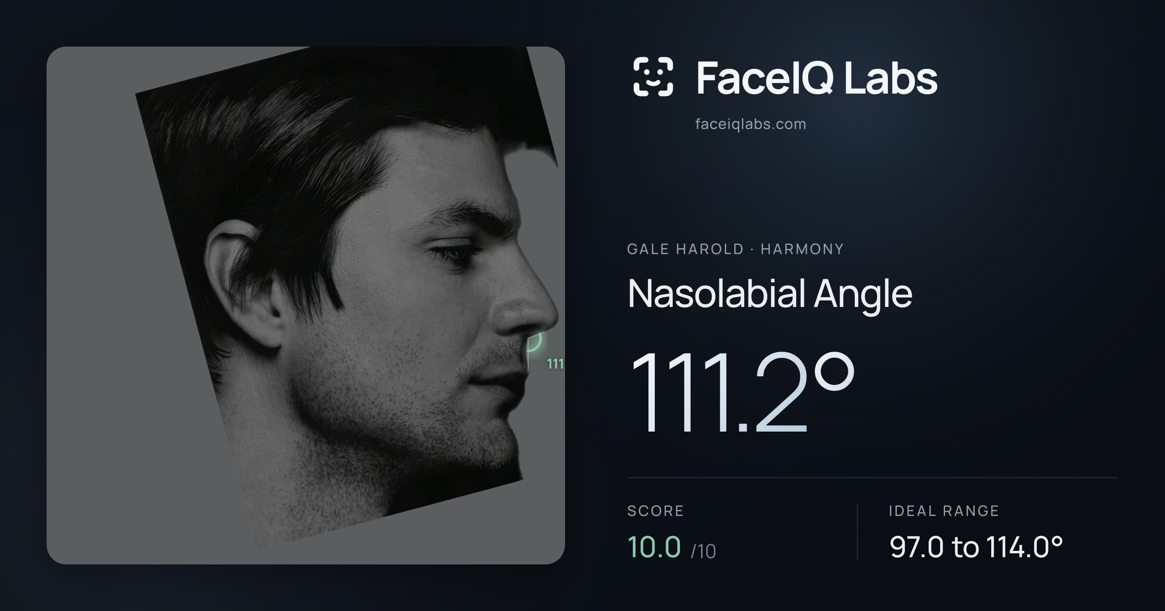 Gale Harold Nasolabial Angle: 111.2°, drawn on the photo