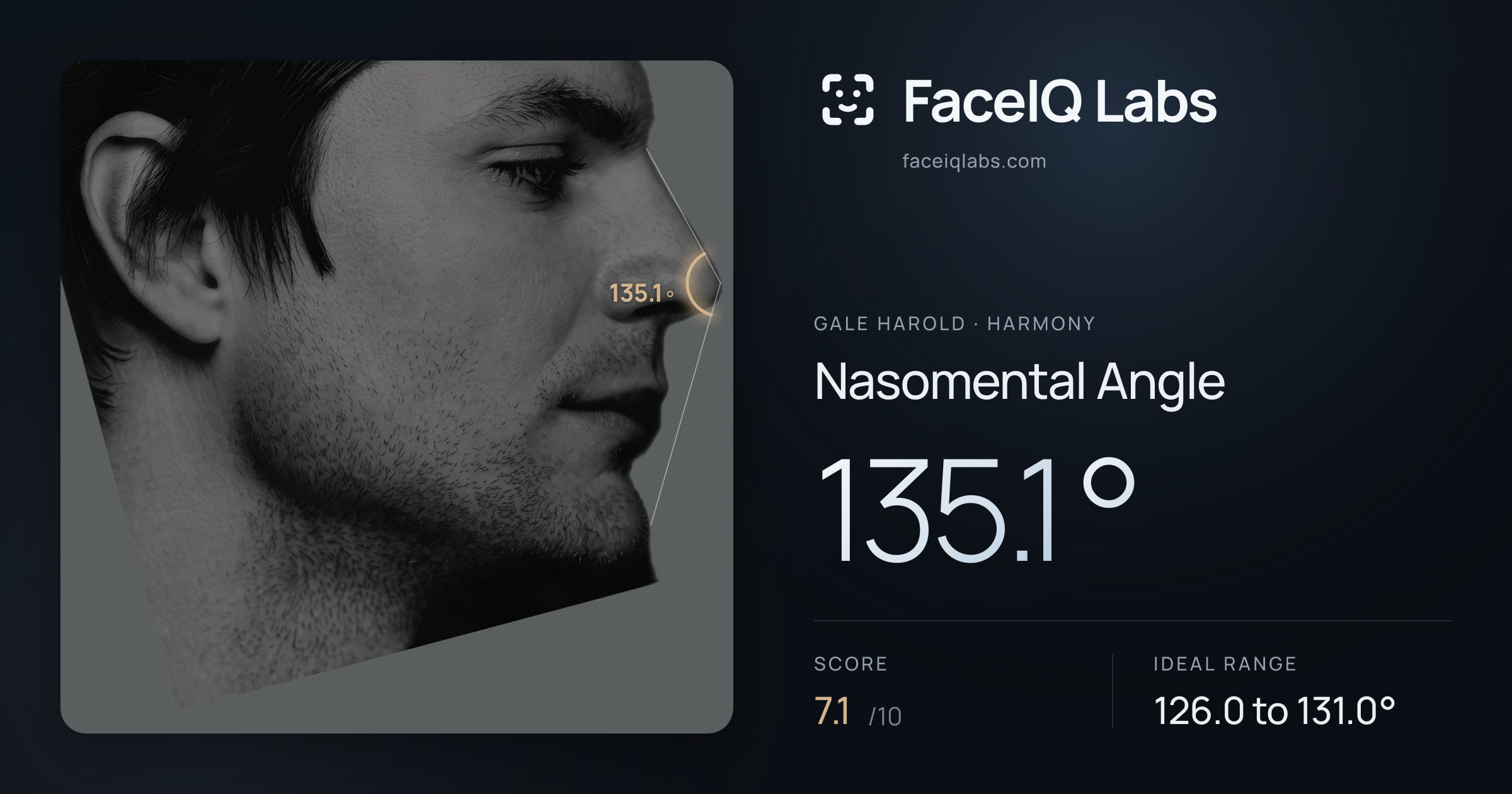 Gale Harold Nasomental Angle: 135.1°, drawn on the photo