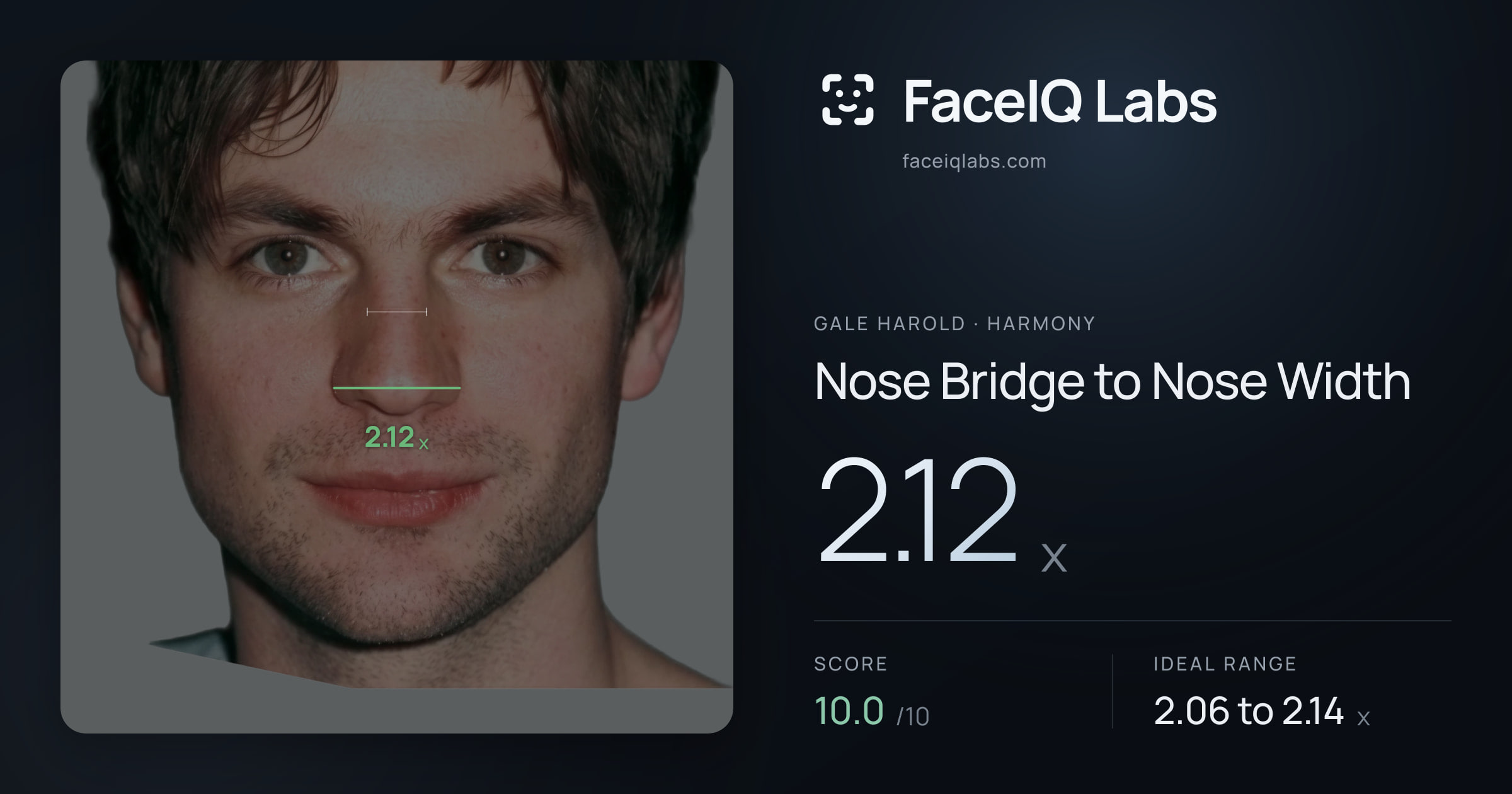 Gale Harold Nose Bridge to Nose Width: 2.12x, drawn on the photo