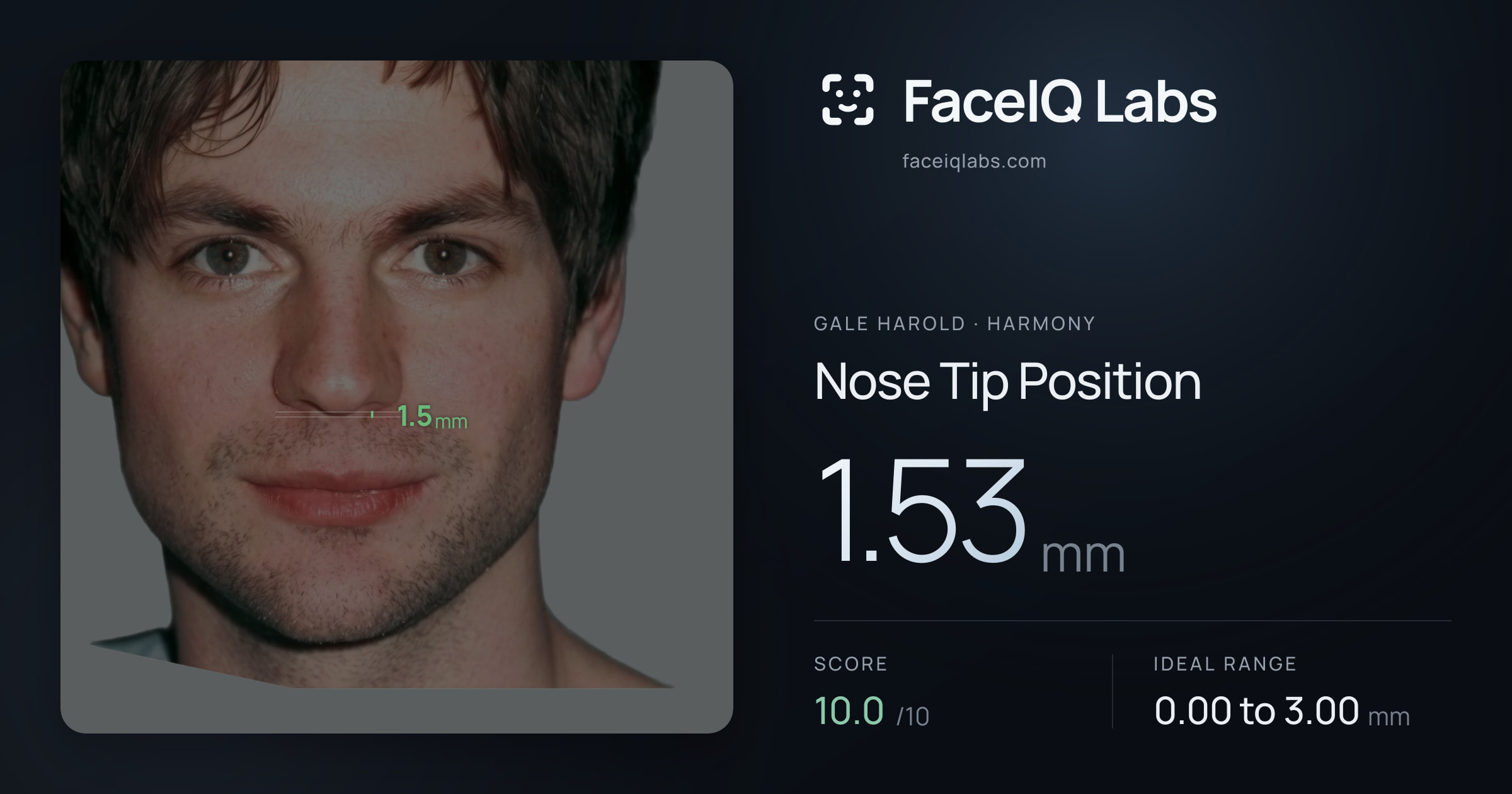 Gale Harold Nose Tip Position: 1.53mm, drawn on the photo