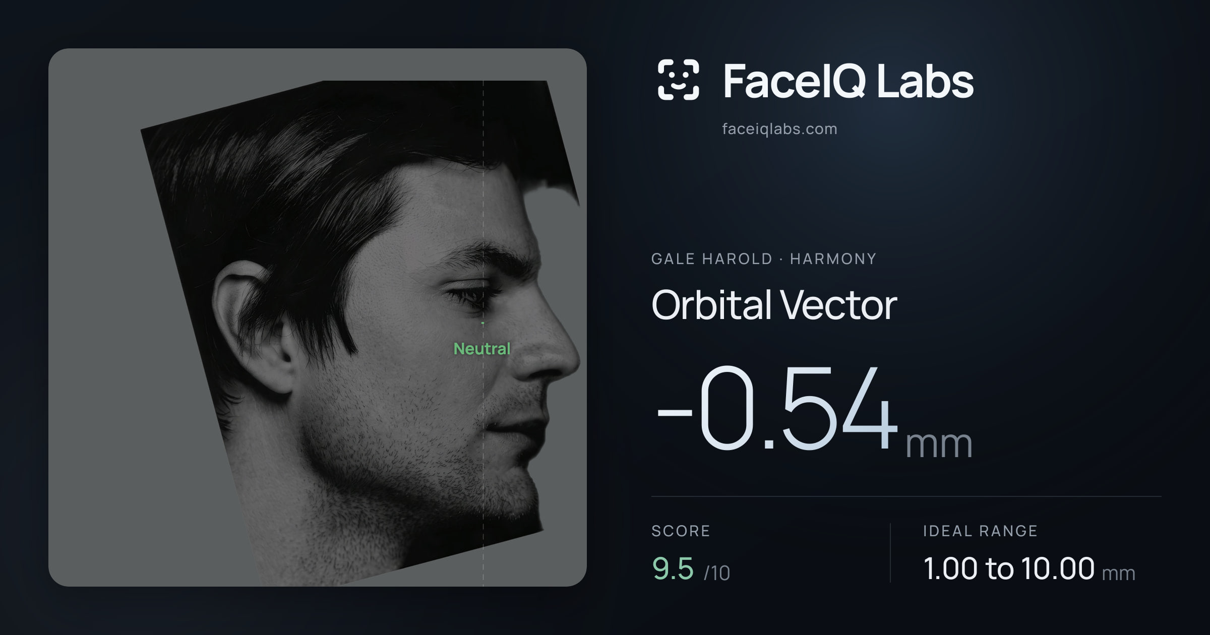 Gale Harold Orbital Vector: -0.54mm, drawn on the photo