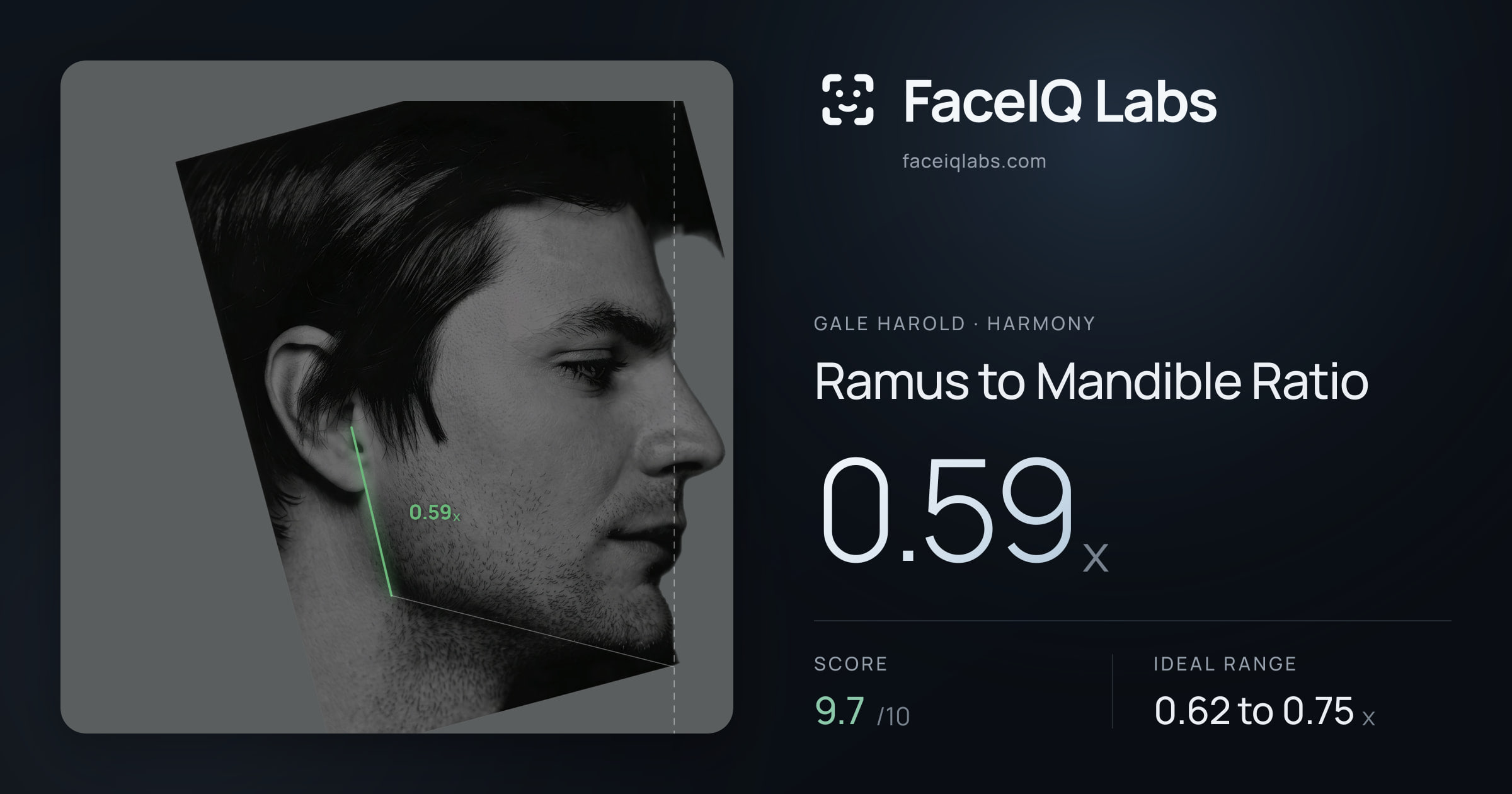Gale Harold Ramus to Mandible Ratio: 0.59x, drawn on the photo