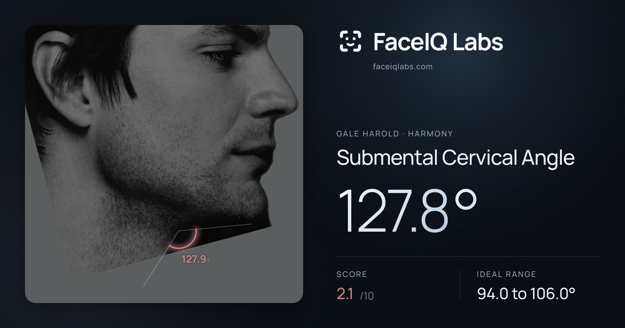 Gale Harold Submental Cervical Angle: 127.8°, drawn on the photo