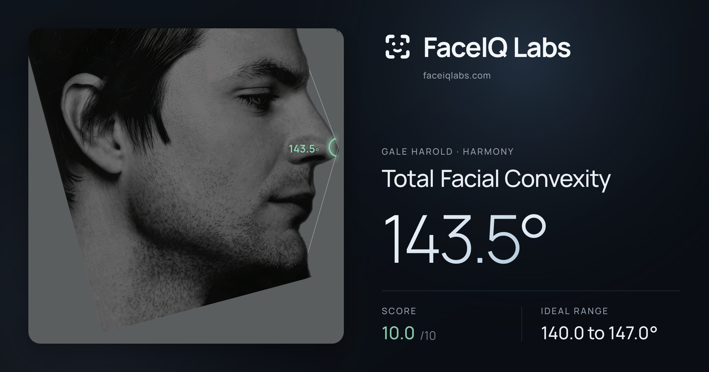 Gale Harold Total Facial Convexity: 143.5°, drawn on the photo