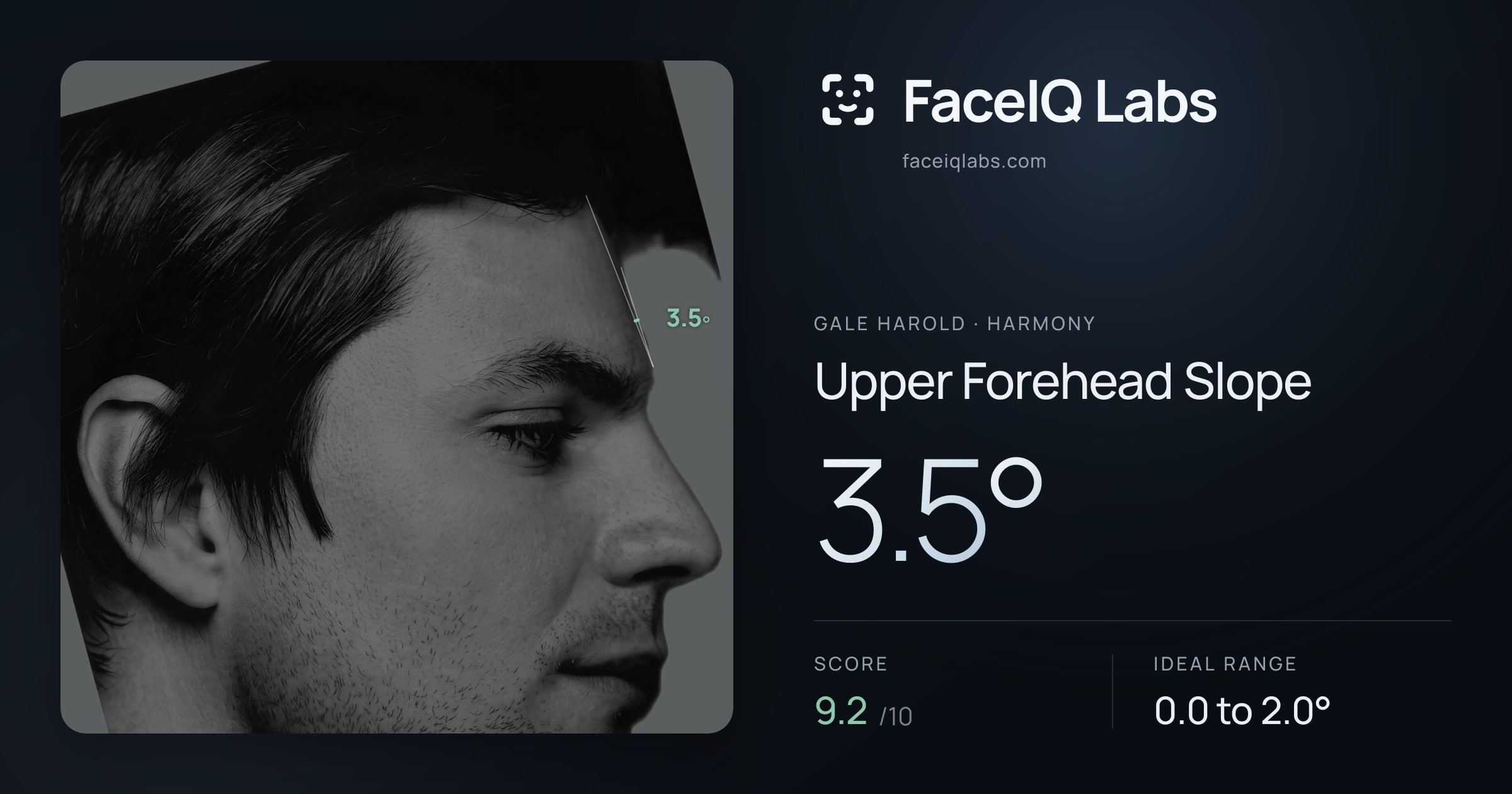 Gale Harold Upper Forehead Slope: 3.5°, drawn on the photo
