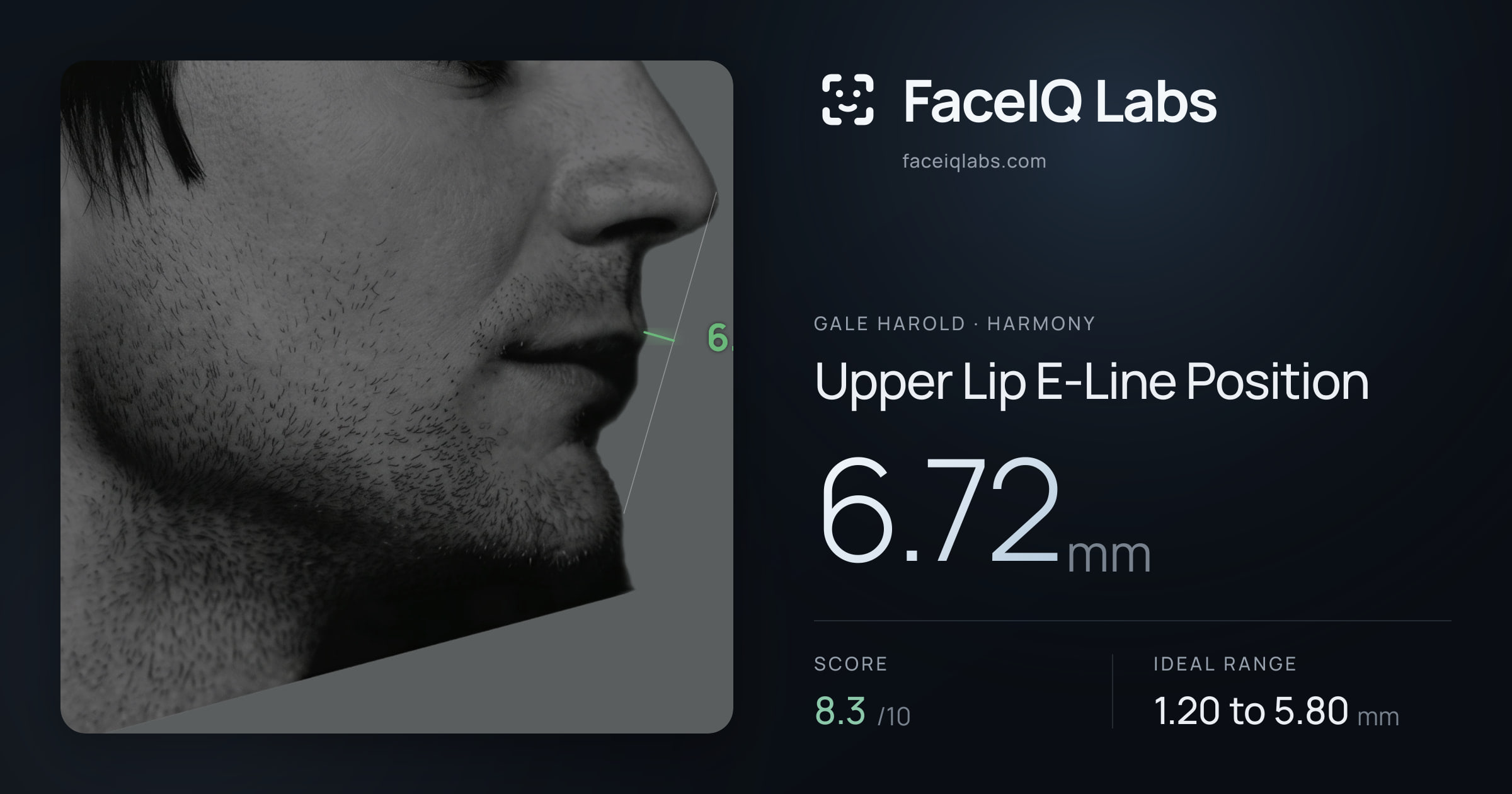Gale Harold Upper Lip E-Line Position: 6.72mm, drawn on the photo