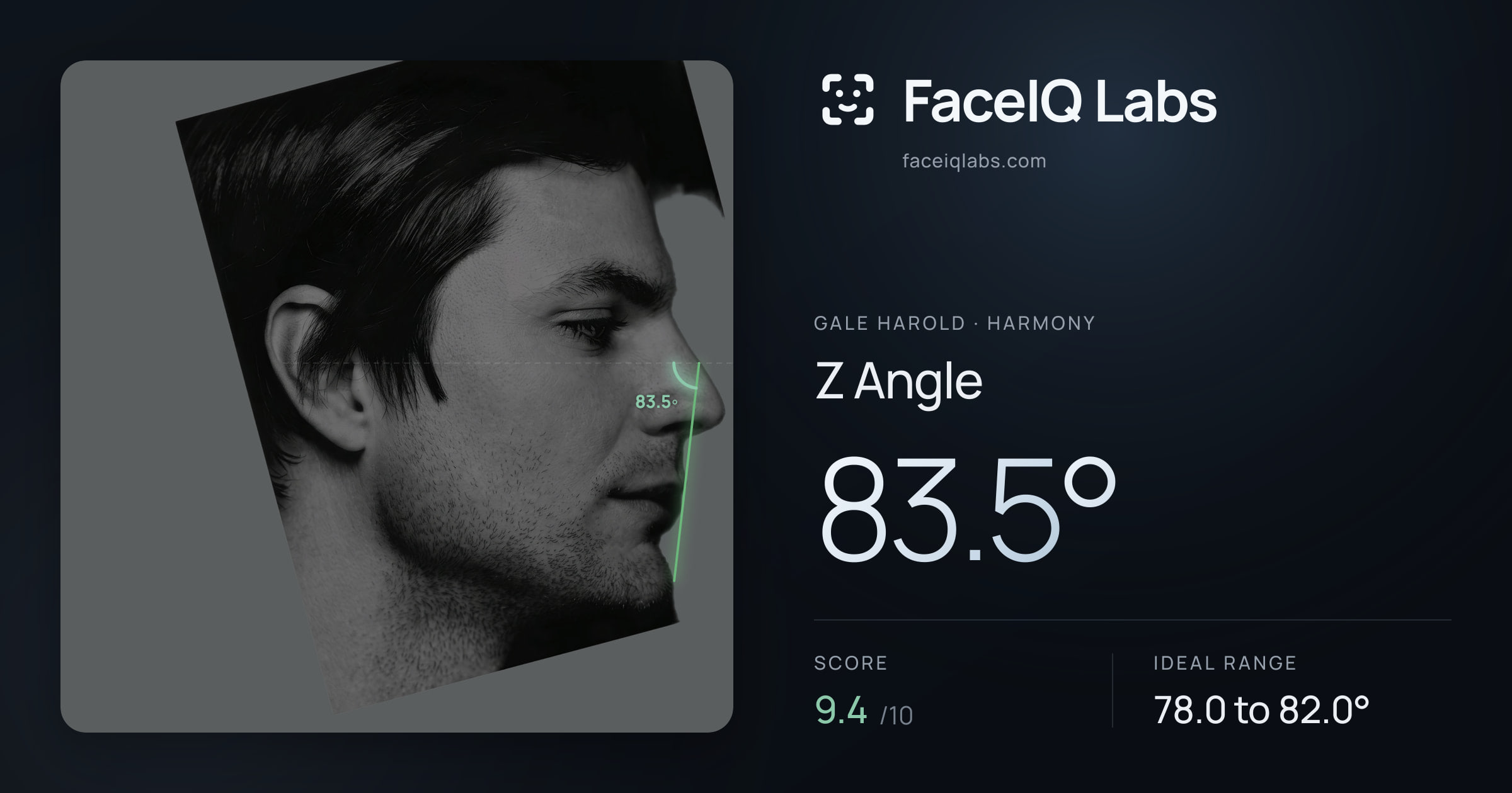Gale Harold Z Angle: 83.5°, drawn on the photo