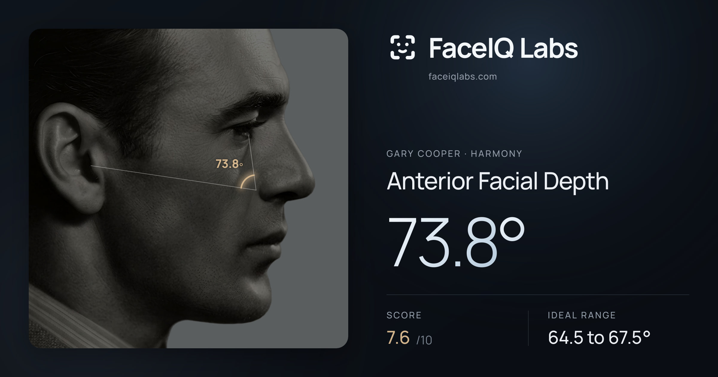 Gary Cooper Anterior Facial Depth: 73.8°, drawn on the photo