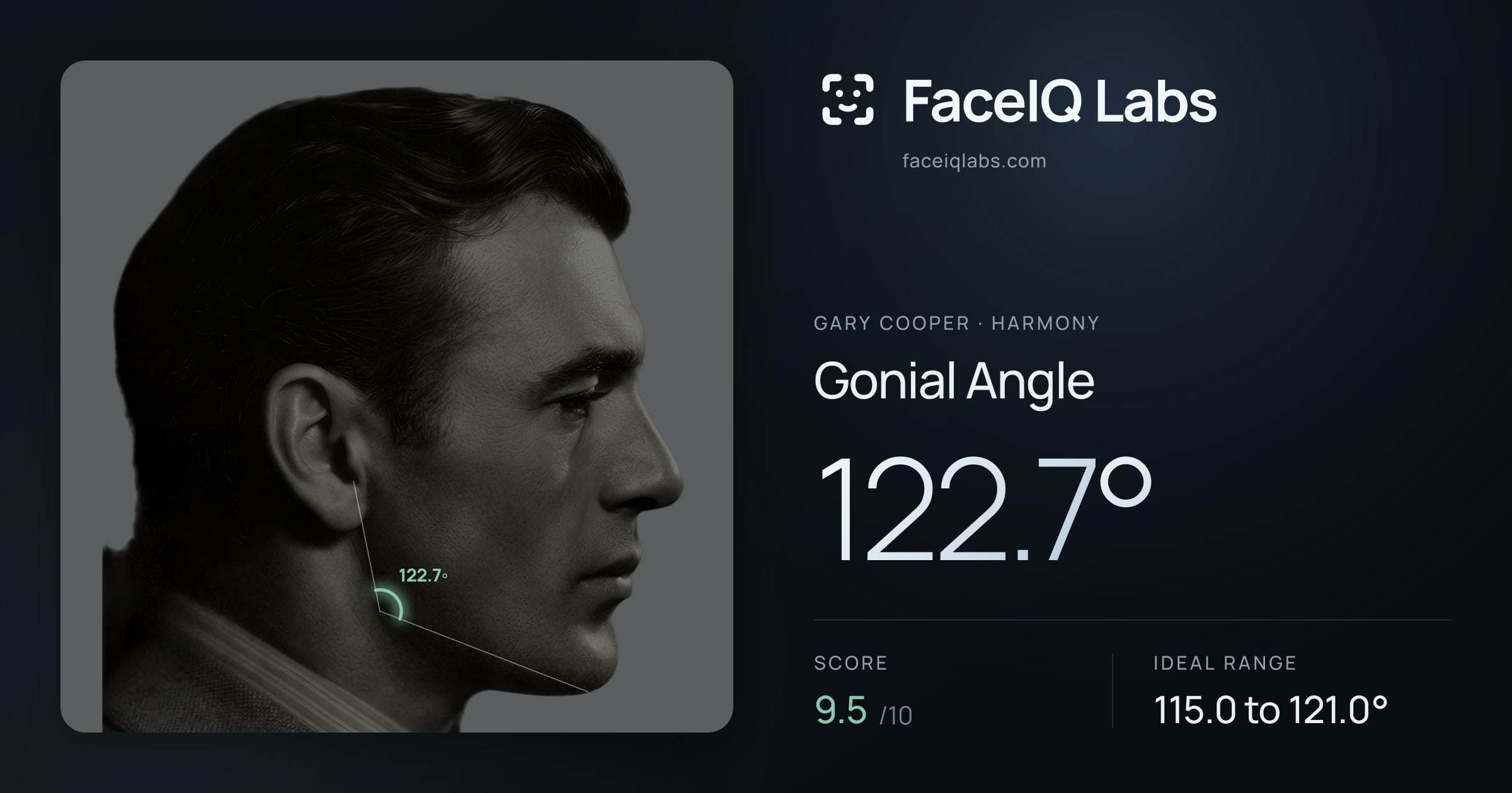 Gary Cooper Gonial Angle: 122.7°, drawn on the photo