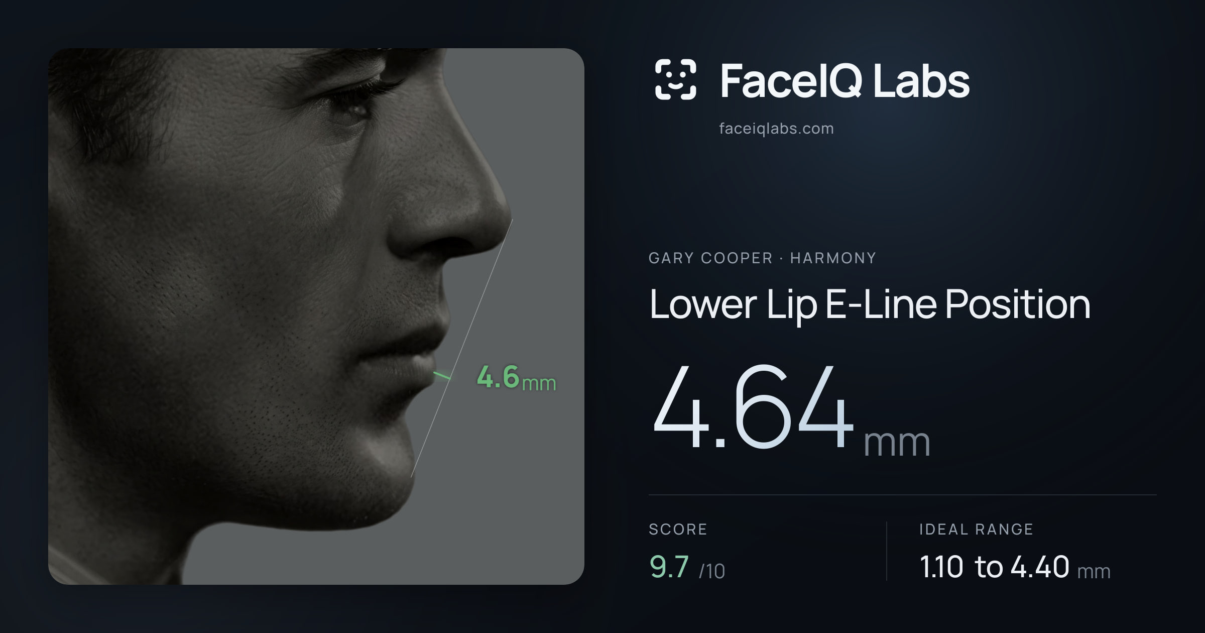 Gary Cooper Lower Lip E-Line Position: 4.64mm, drawn on the photo