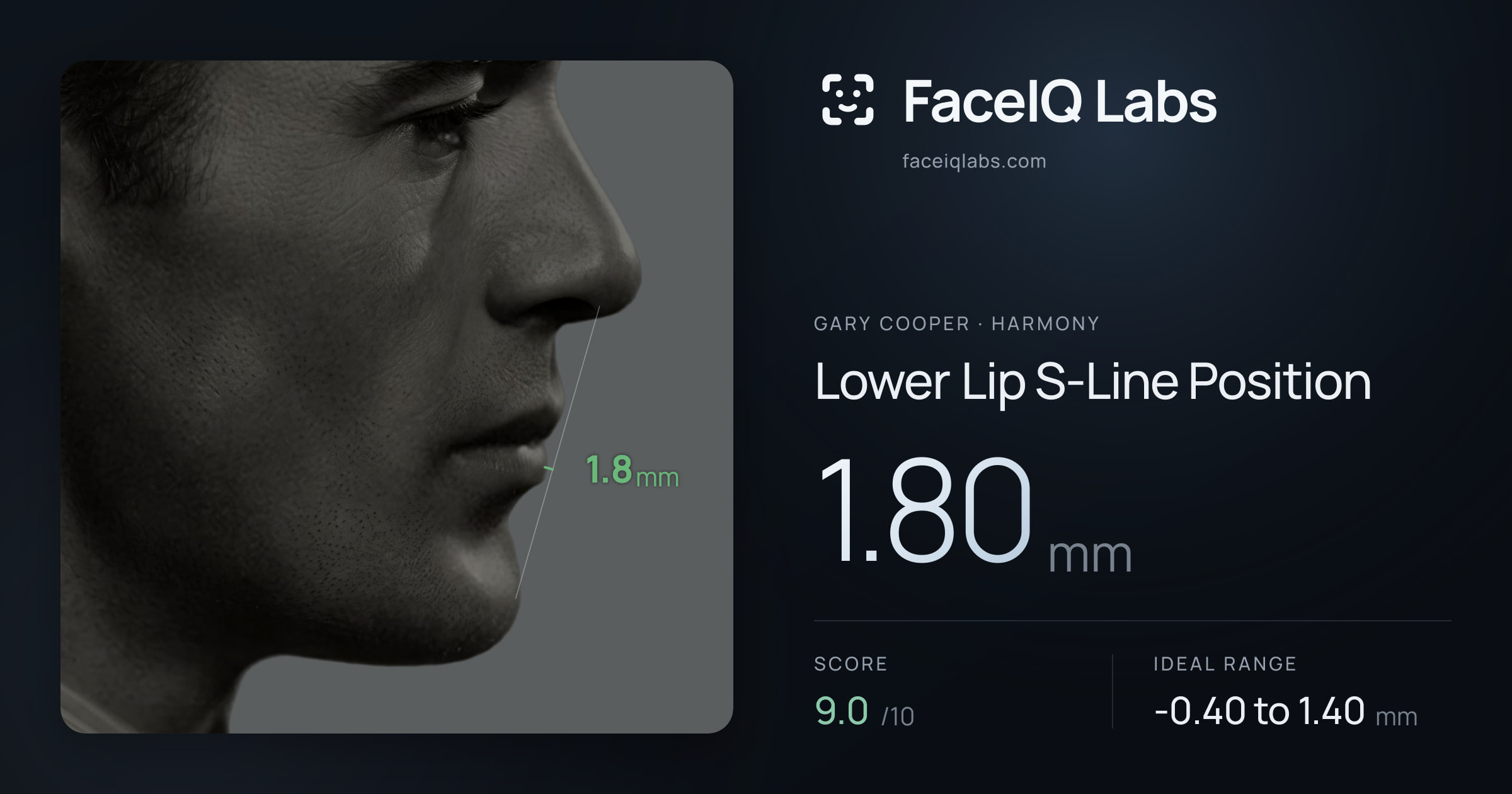 Gary Cooper Lower Lip S-Line Position: 1.80mm, drawn on the photo