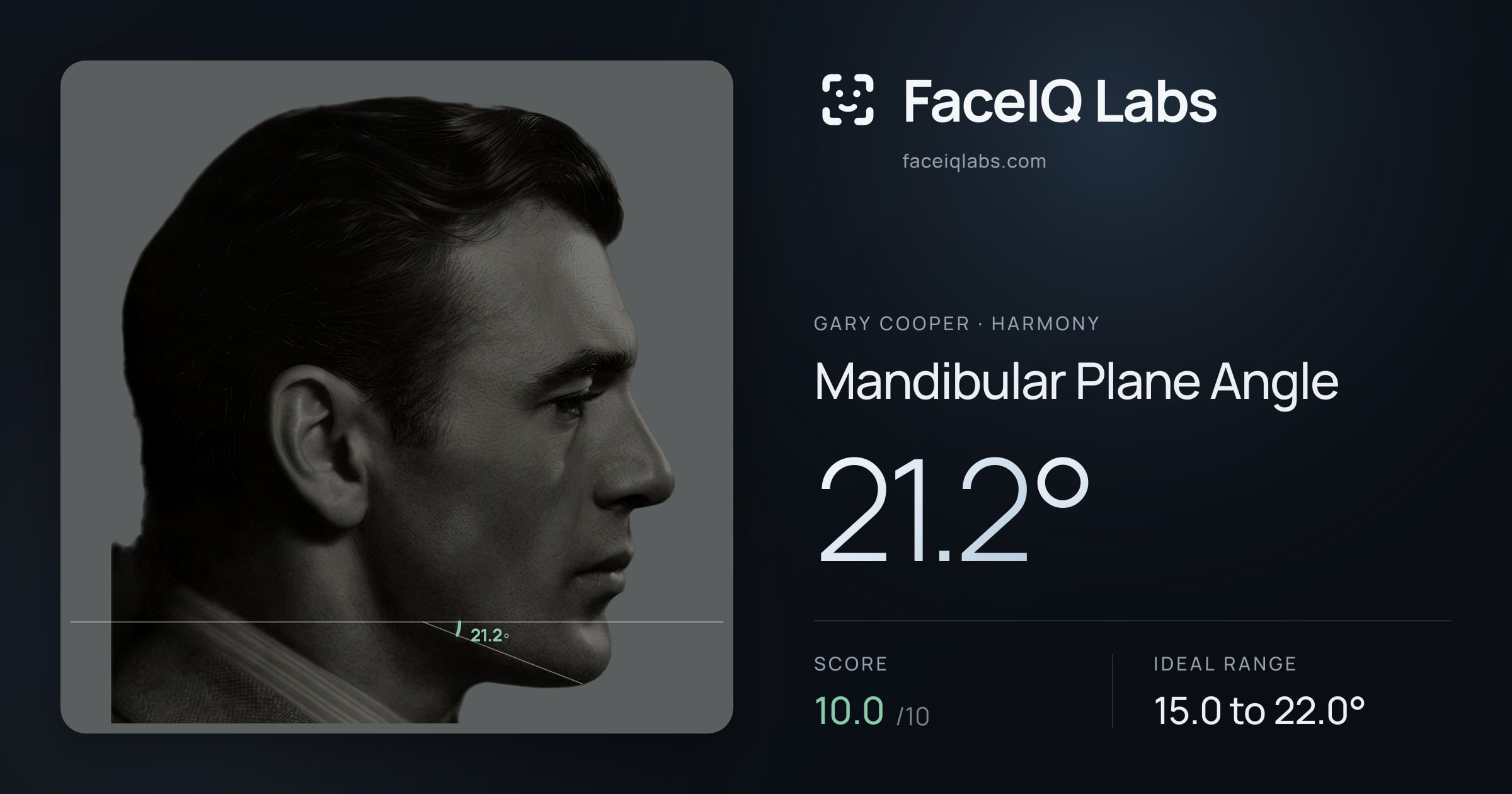 Gary Cooper Mandibular Plane Angle: 21.2°, drawn on the photo