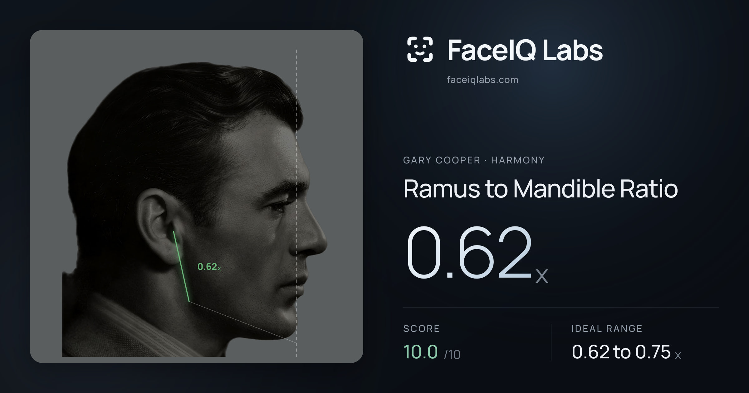 Gary Cooper Ramus to Mandible Ratio: 0.62x, drawn on the photo