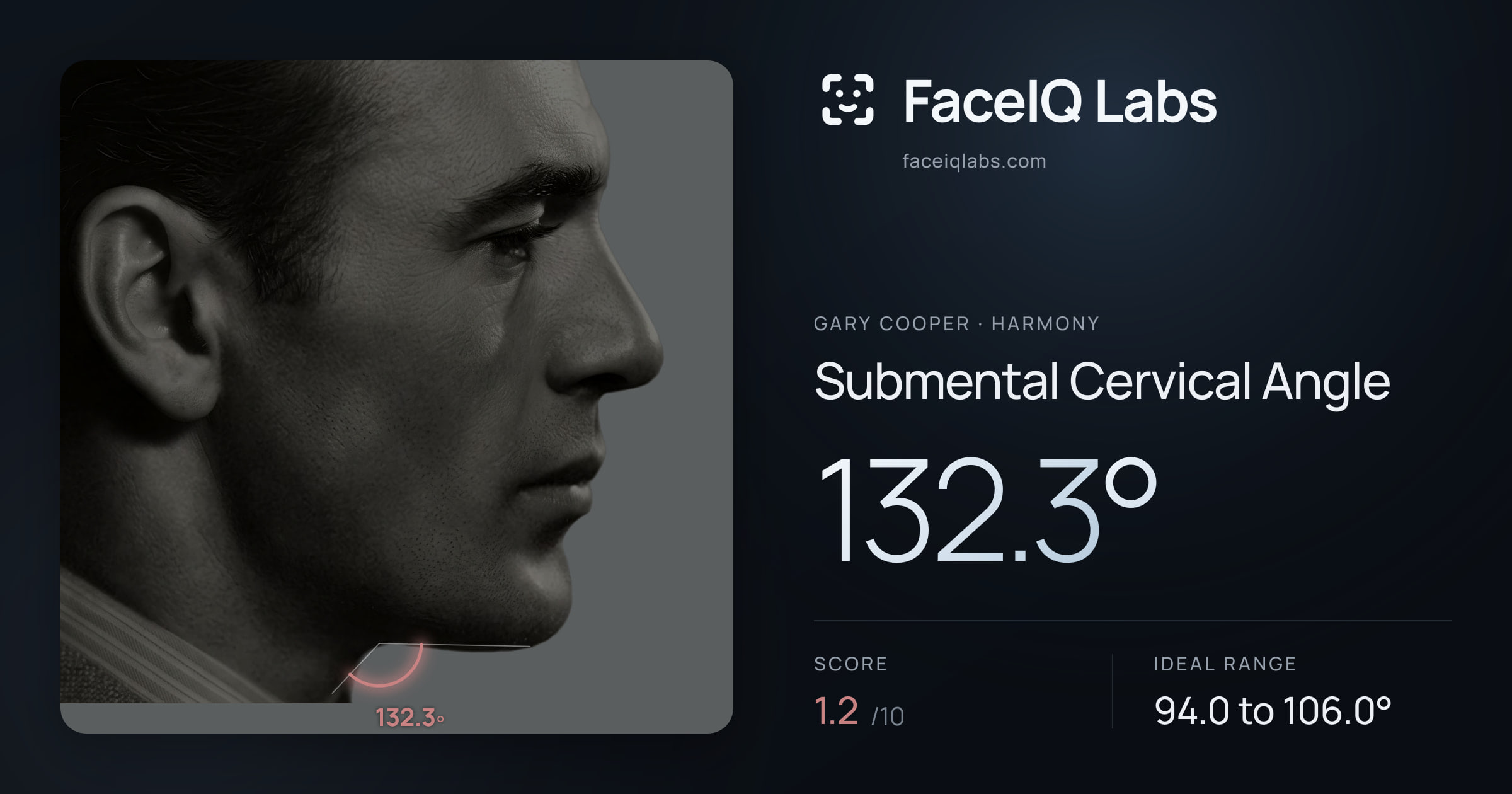 Gary Cooper Submental Cervical Angle: 132.3°, drawn on the photo