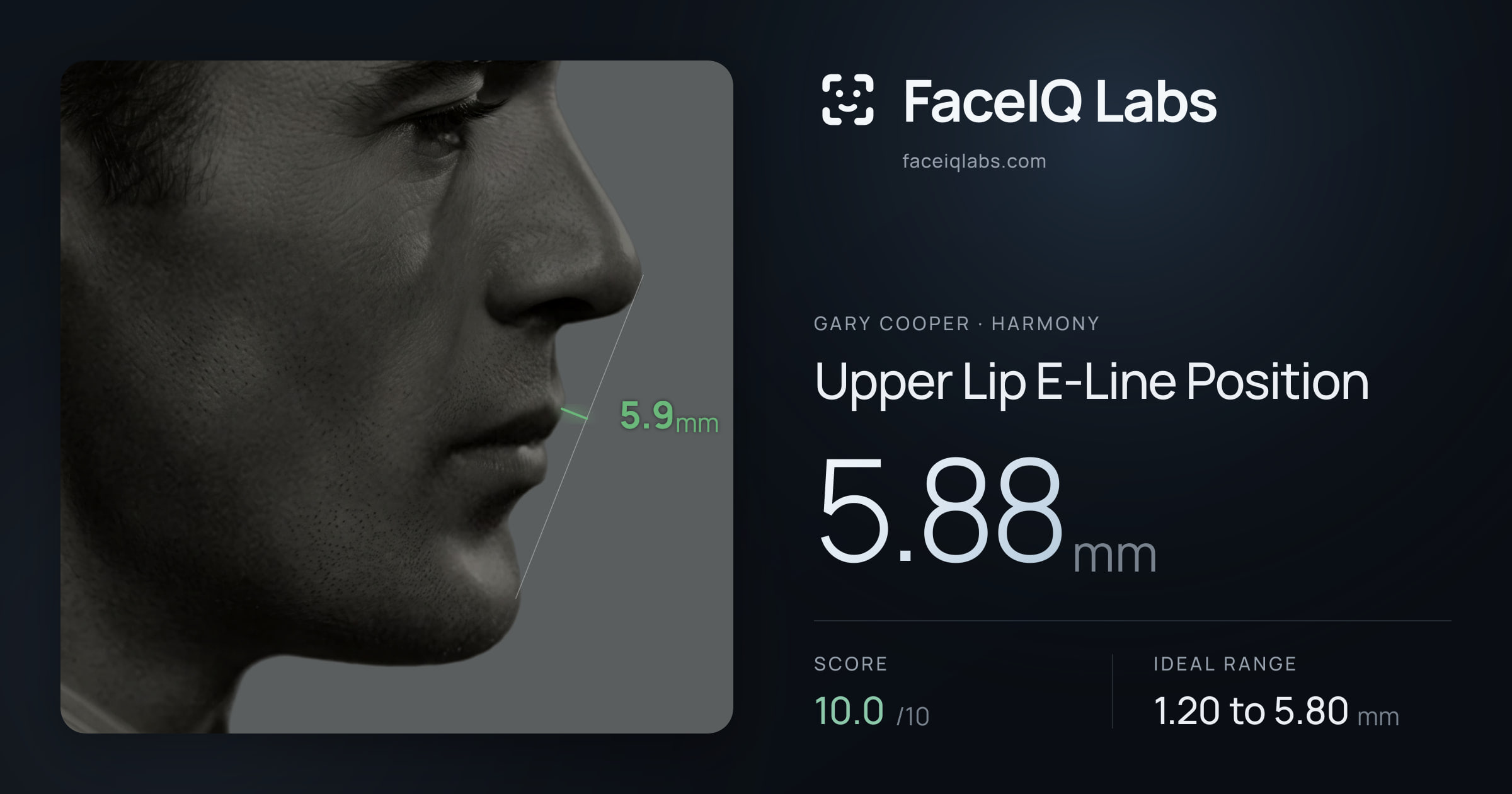 Gary Cooper Upper Lip E-Line Position: 5.88mm, drawn on the photo