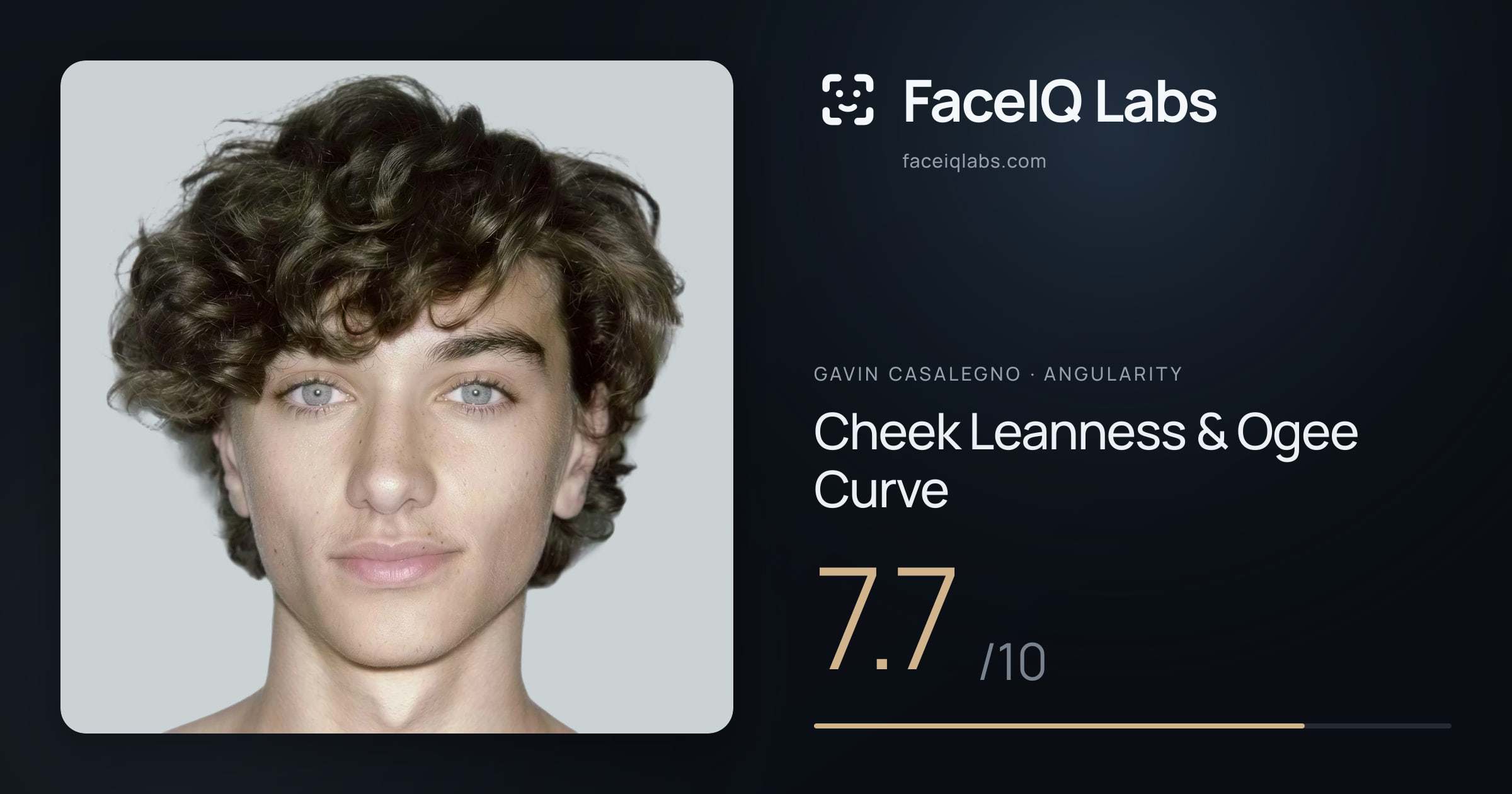 Gavin Casalegno Cheek Leanness & Ogee Curve: 7.7/10, drawn on the photo