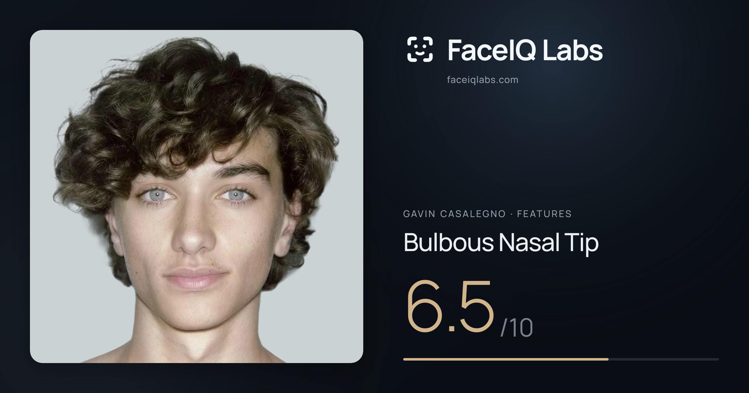 Gavin Casalegno Bulbous Nasal Tip: 6.5/10, drawn on the photo