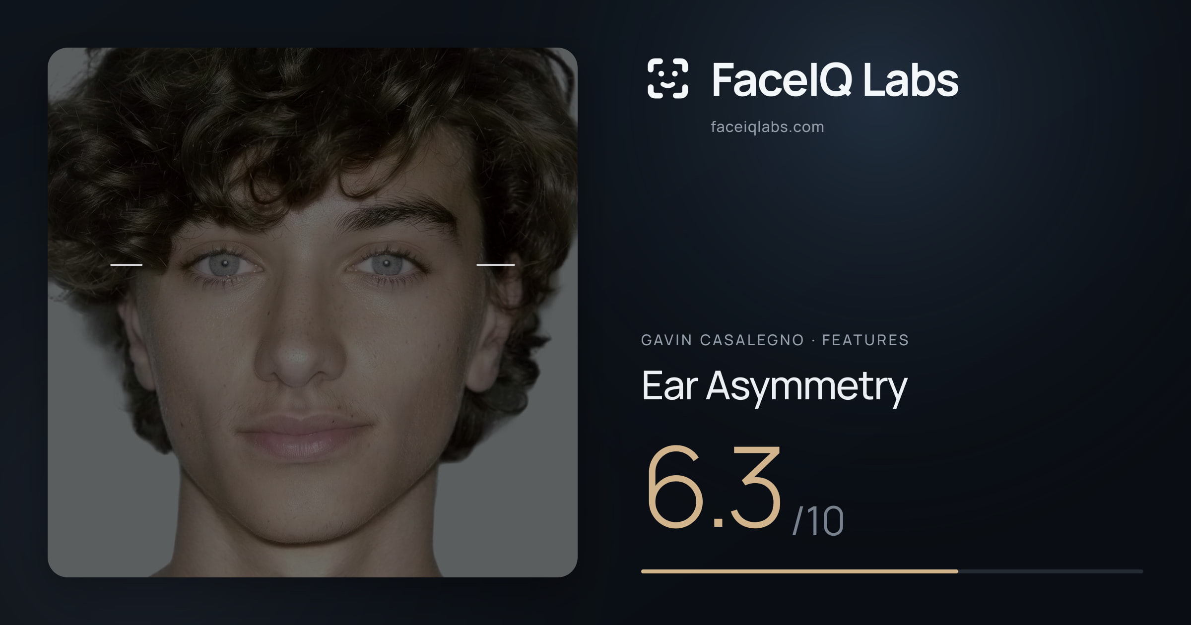 Gavin Casalegno Ear Asymmetry: 6.3/10, drawn on the photo