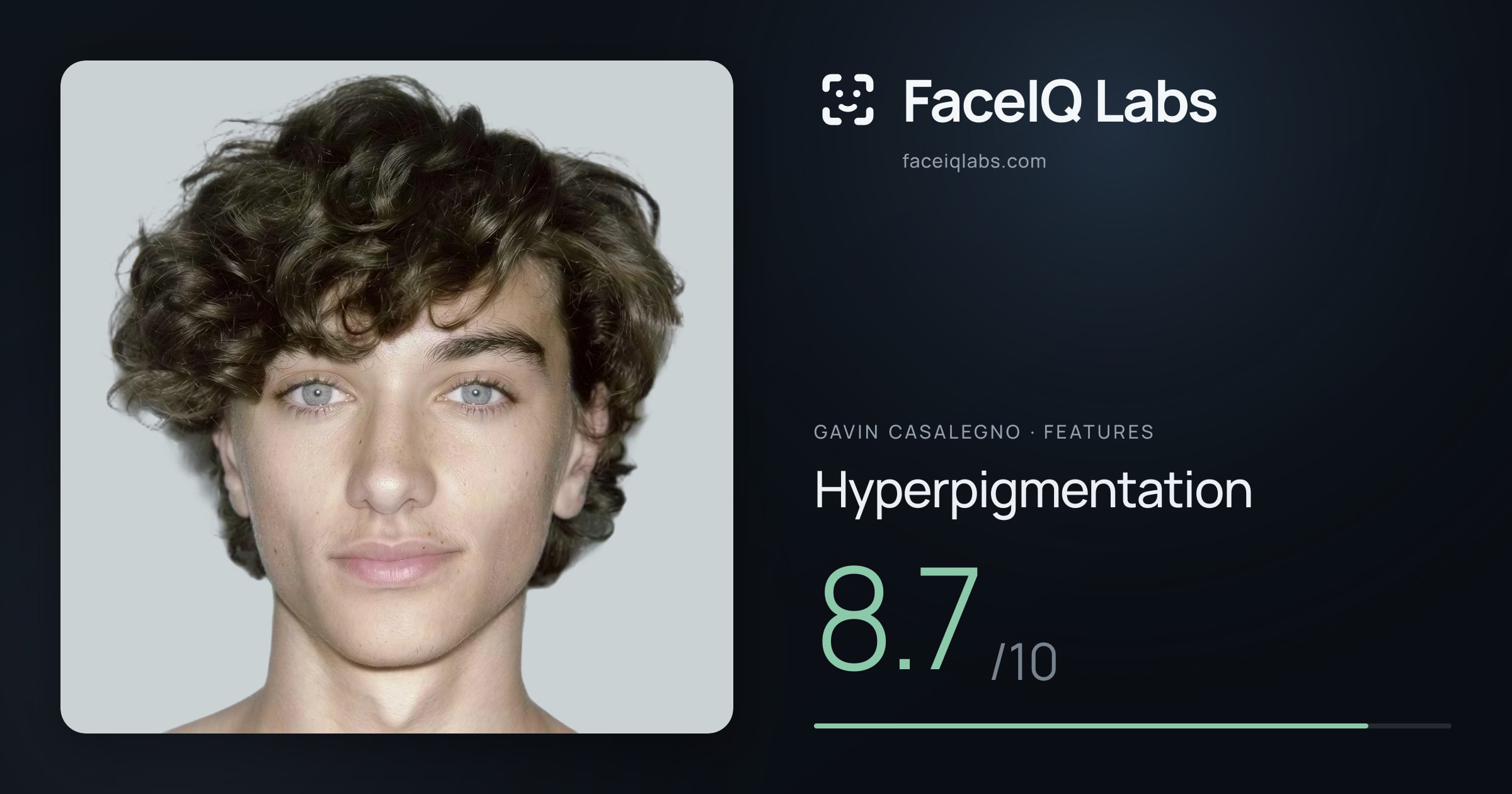 Gavin Casalegno Hyperpigmentation: 8.7/10, drawn on the photo