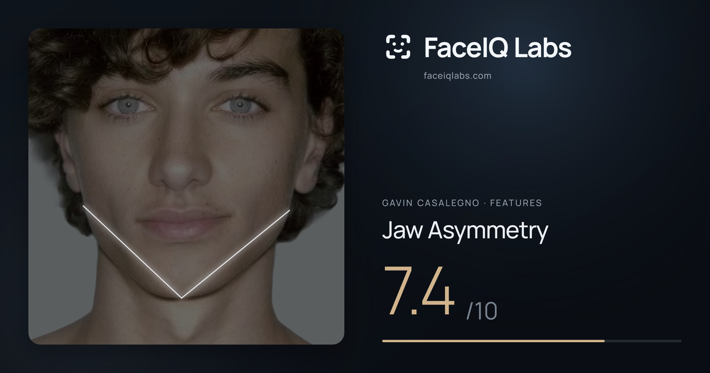 Gavin Casalegno Jaw Asymmetry: 7.4/10, drawn on the photo