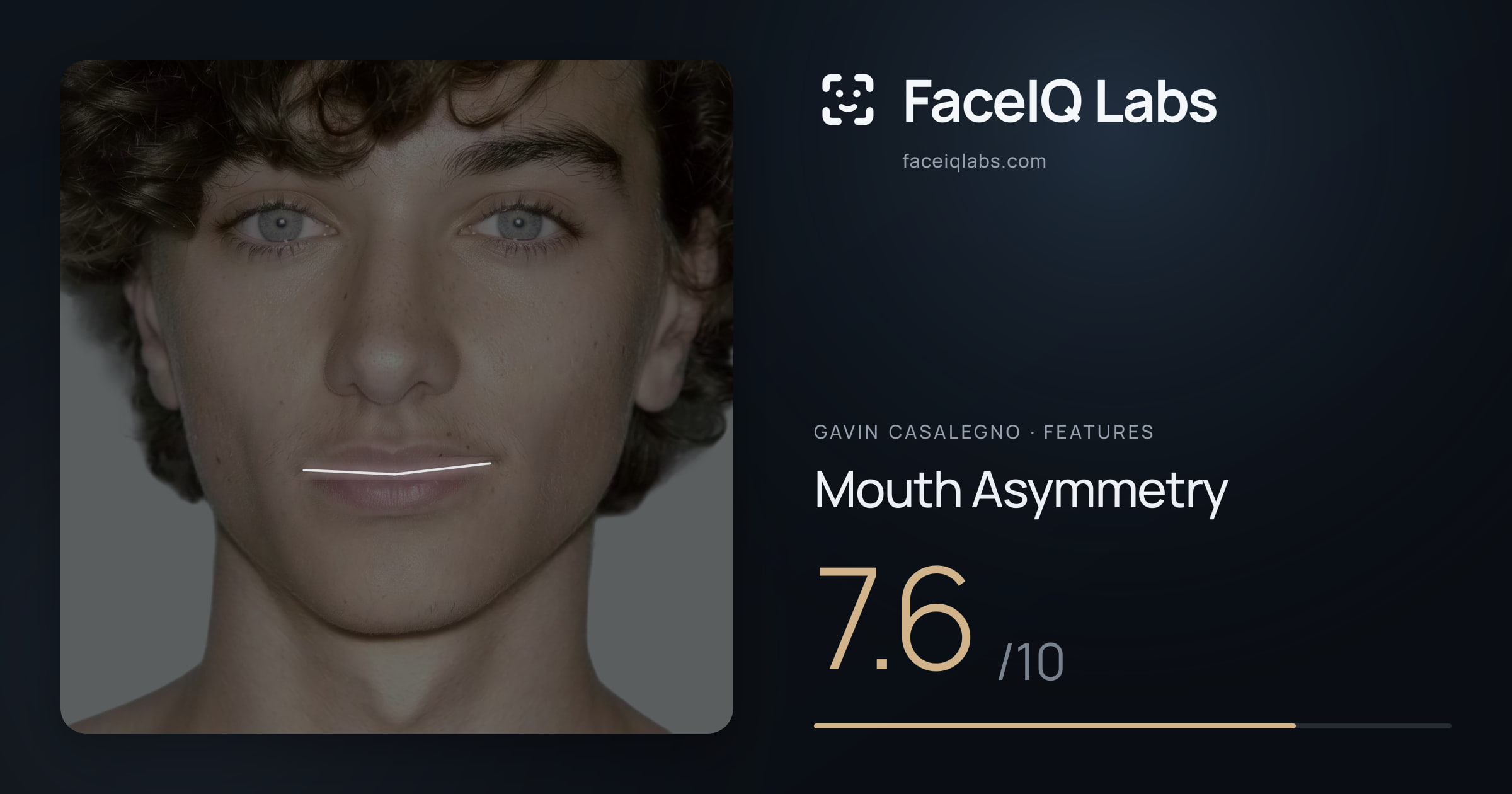 Gavin Casalegno Mouth Asymmetry: 7.6/10, drawn on the photo