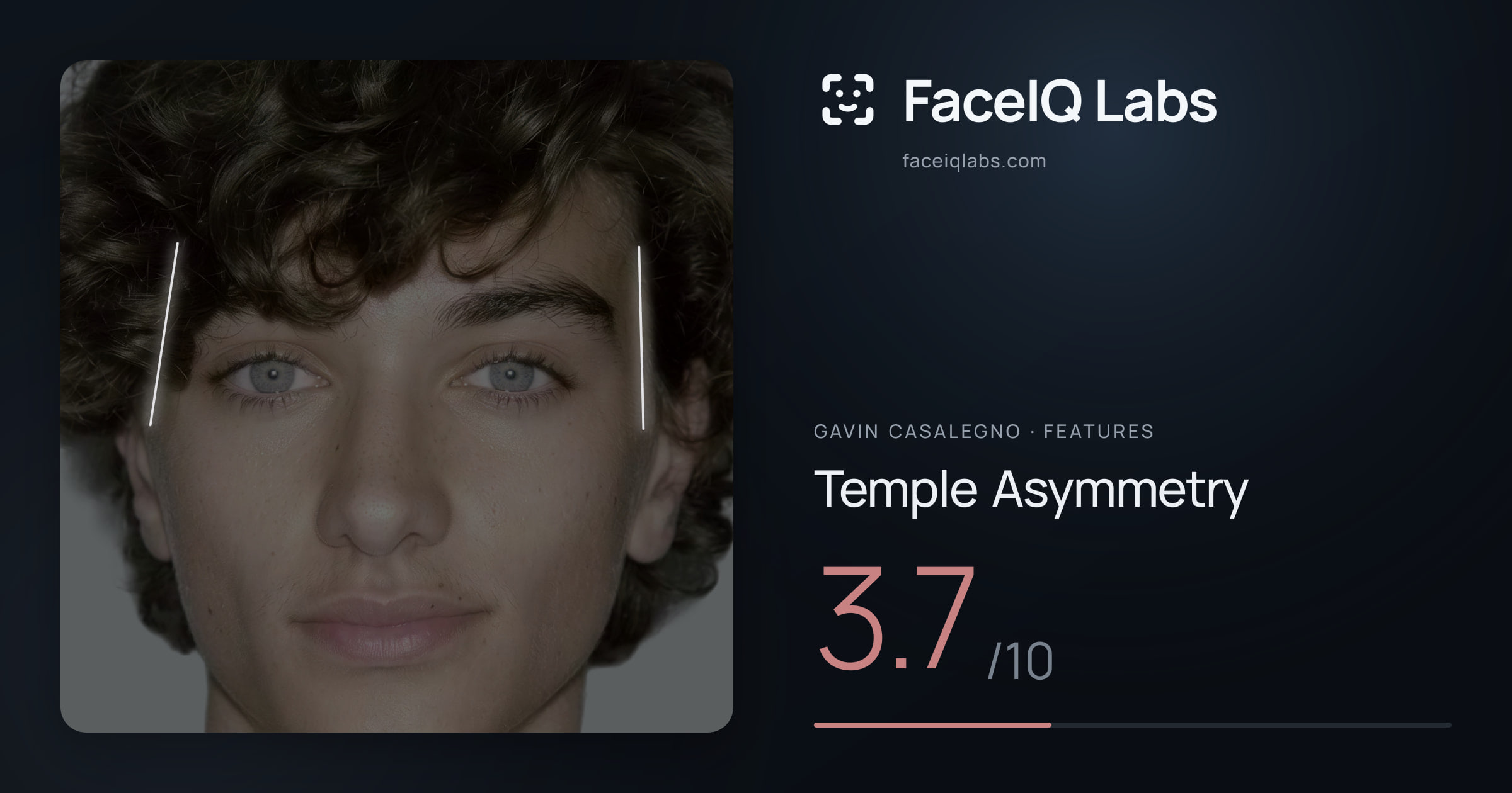 Gavin Casalegno Temple Asymmetry: 3.7/10, drawn on the photo