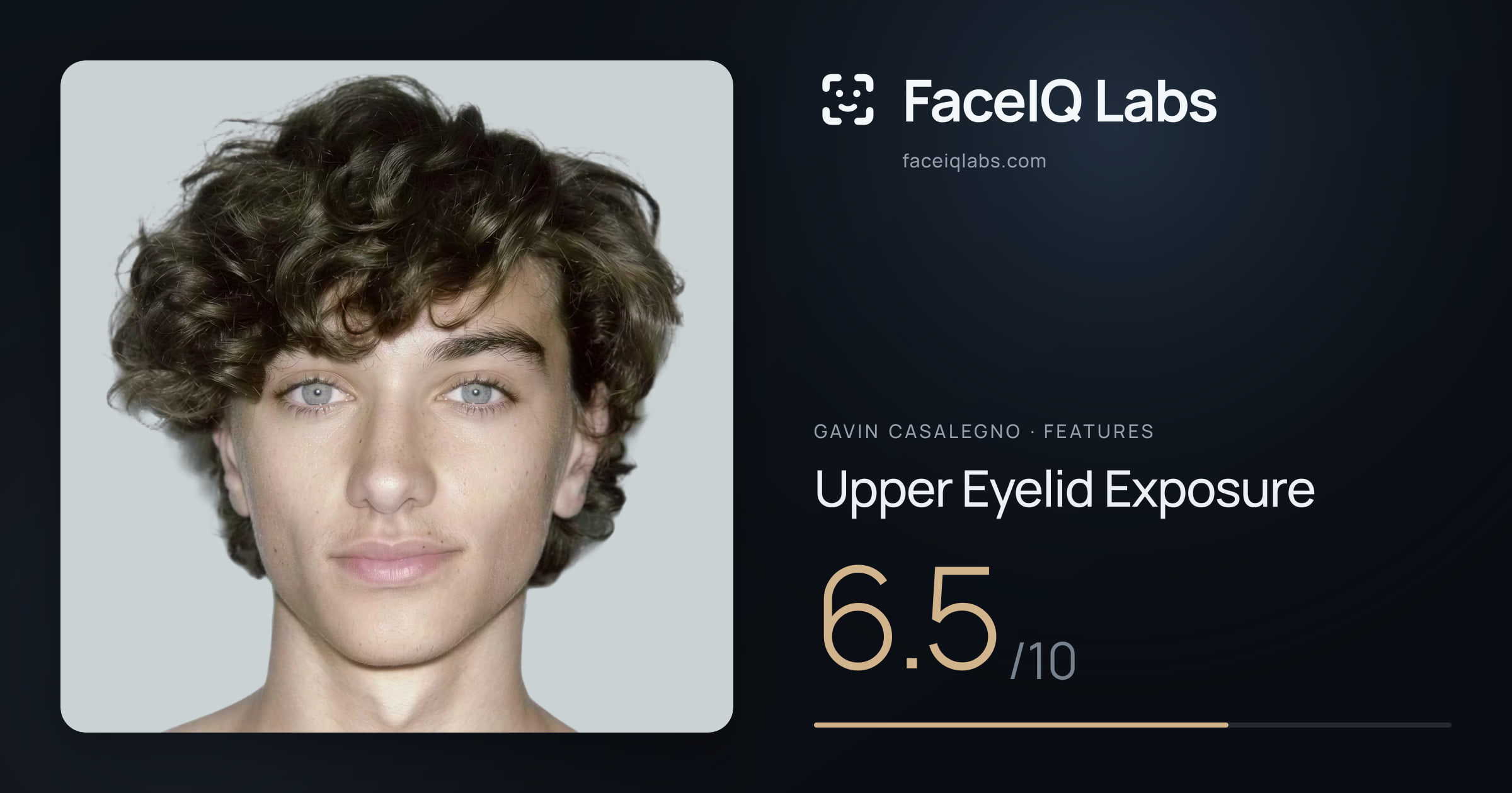 Gavin Casalegno Upper Eyelid Exposure: 6.5/10, drawn on the photo