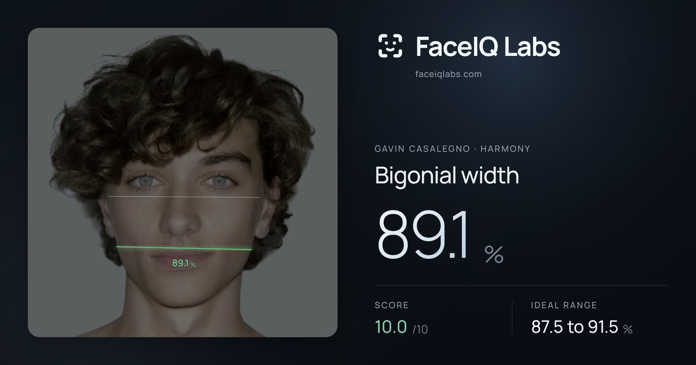 Gavin Casalegno Bigonial width: 89.1%, drawn on the photo