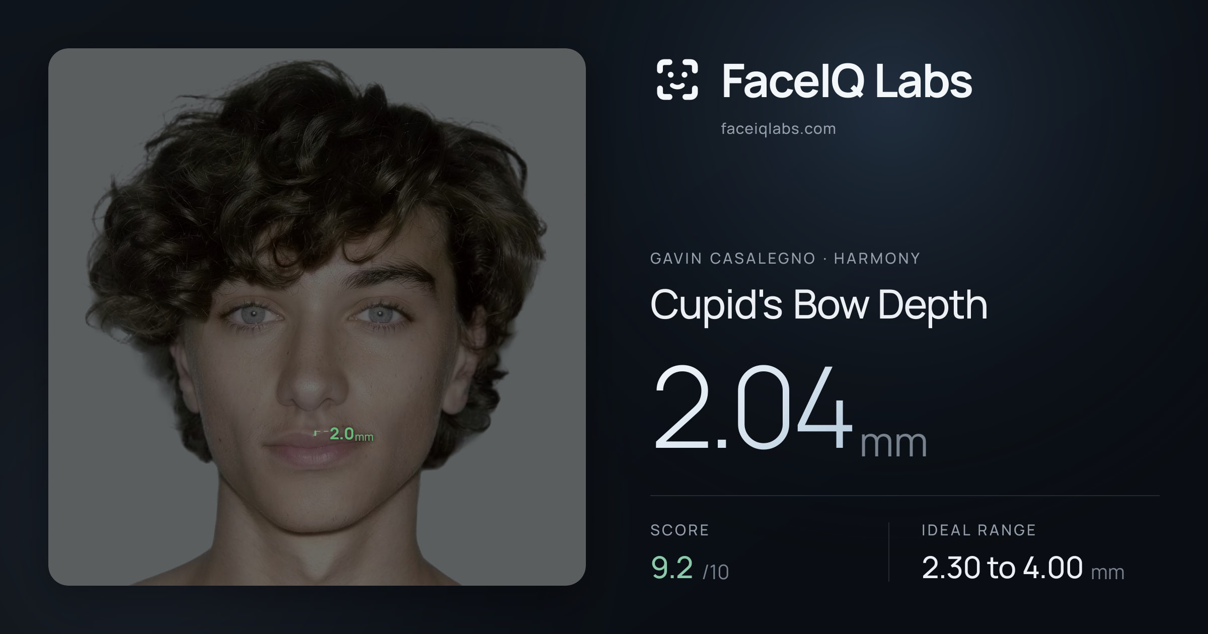 Gavin Casalegno Cupid's Bow Depth: 2.04mm, drawn on the photo