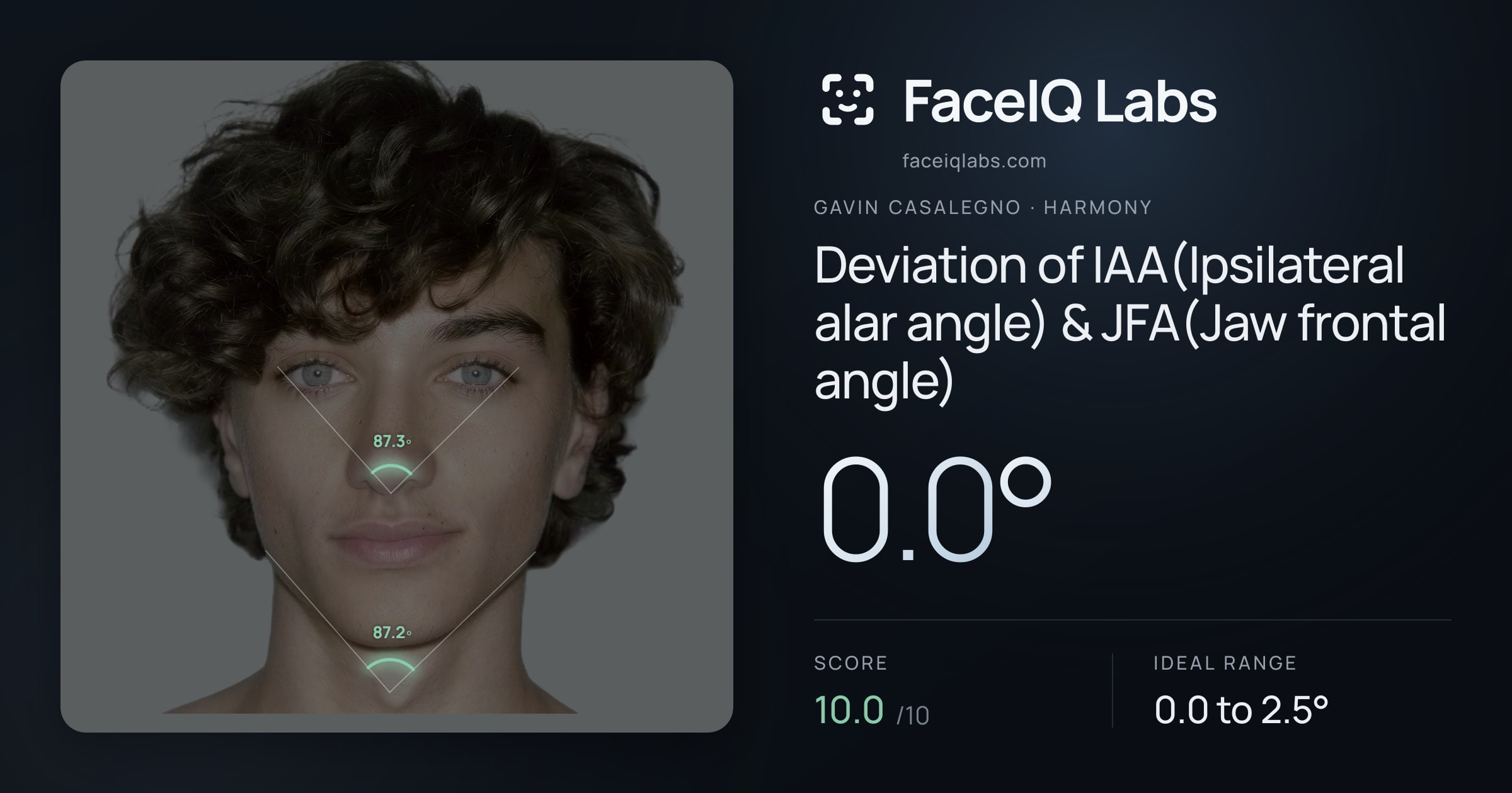 Gavin Casalegno Deviation of IAA(Ipsilateral alar angle) & JFA(Jaw frontal angle): 0.0°, drawn on the photo