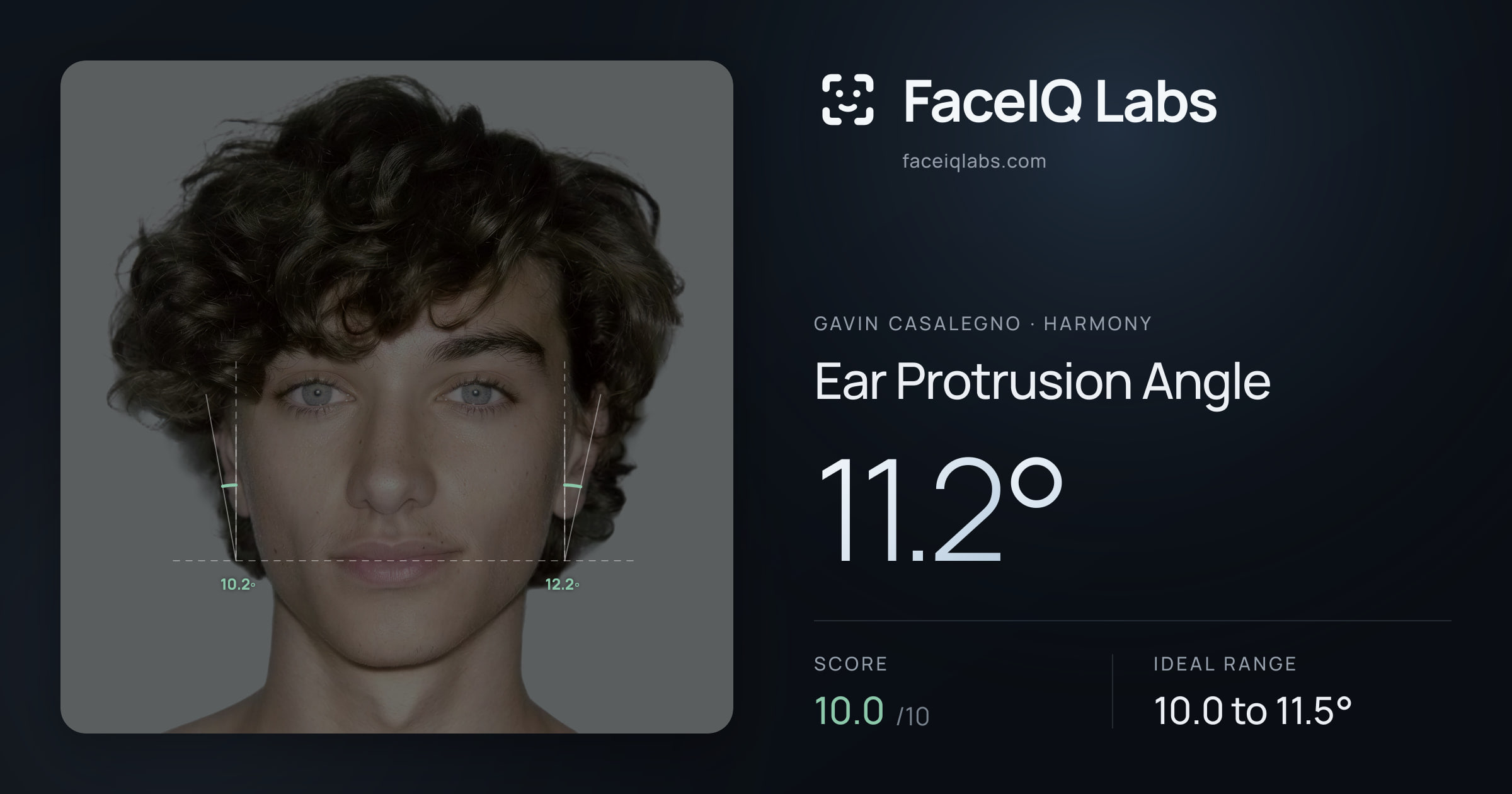 Gavin Casalegno Ear Protrusion Angle: 11.2°, drawn on the photo