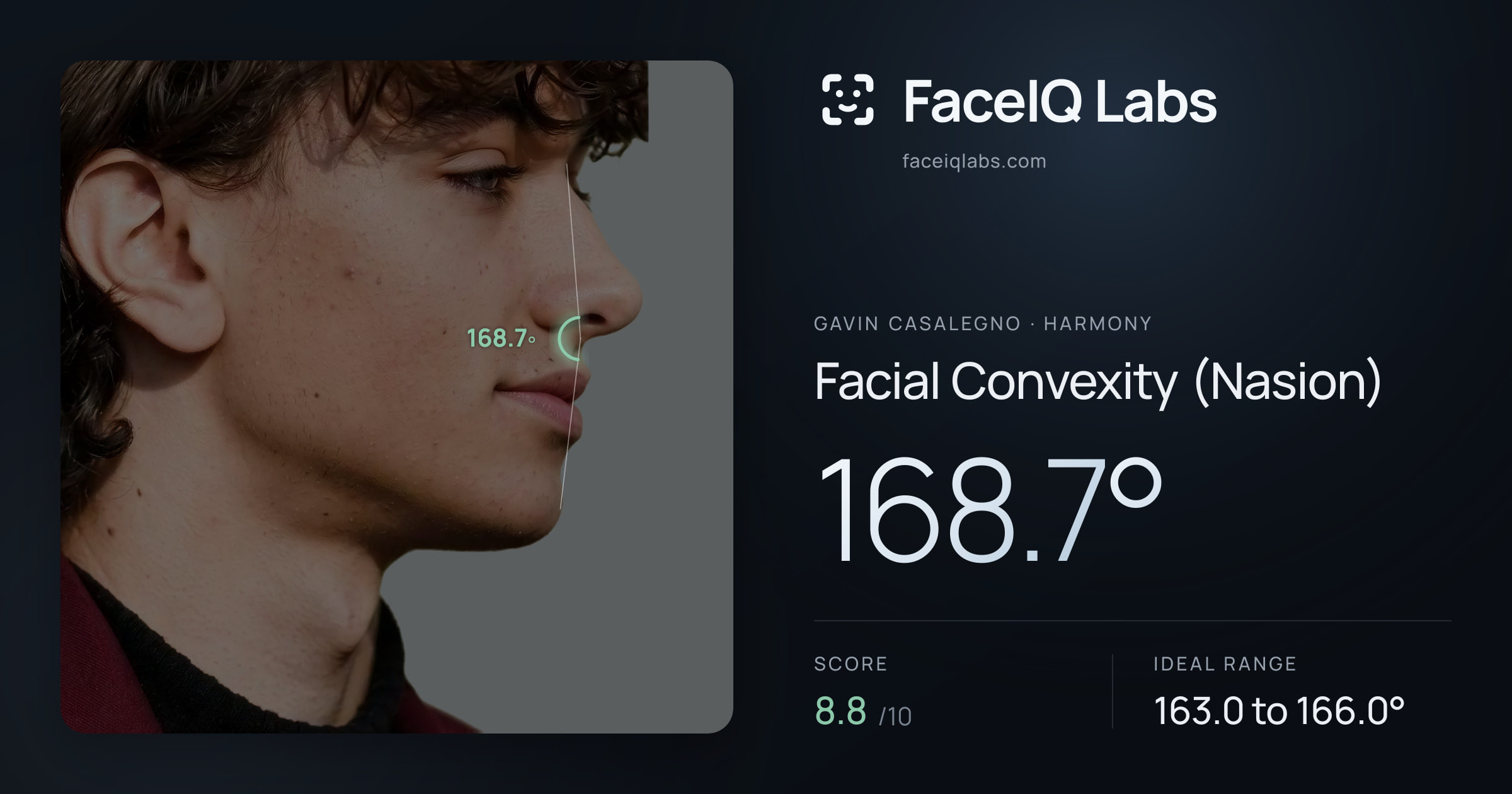 Gavin Casalegno Facial Convexity (Nasion): 168.7°, drawn on the photo
