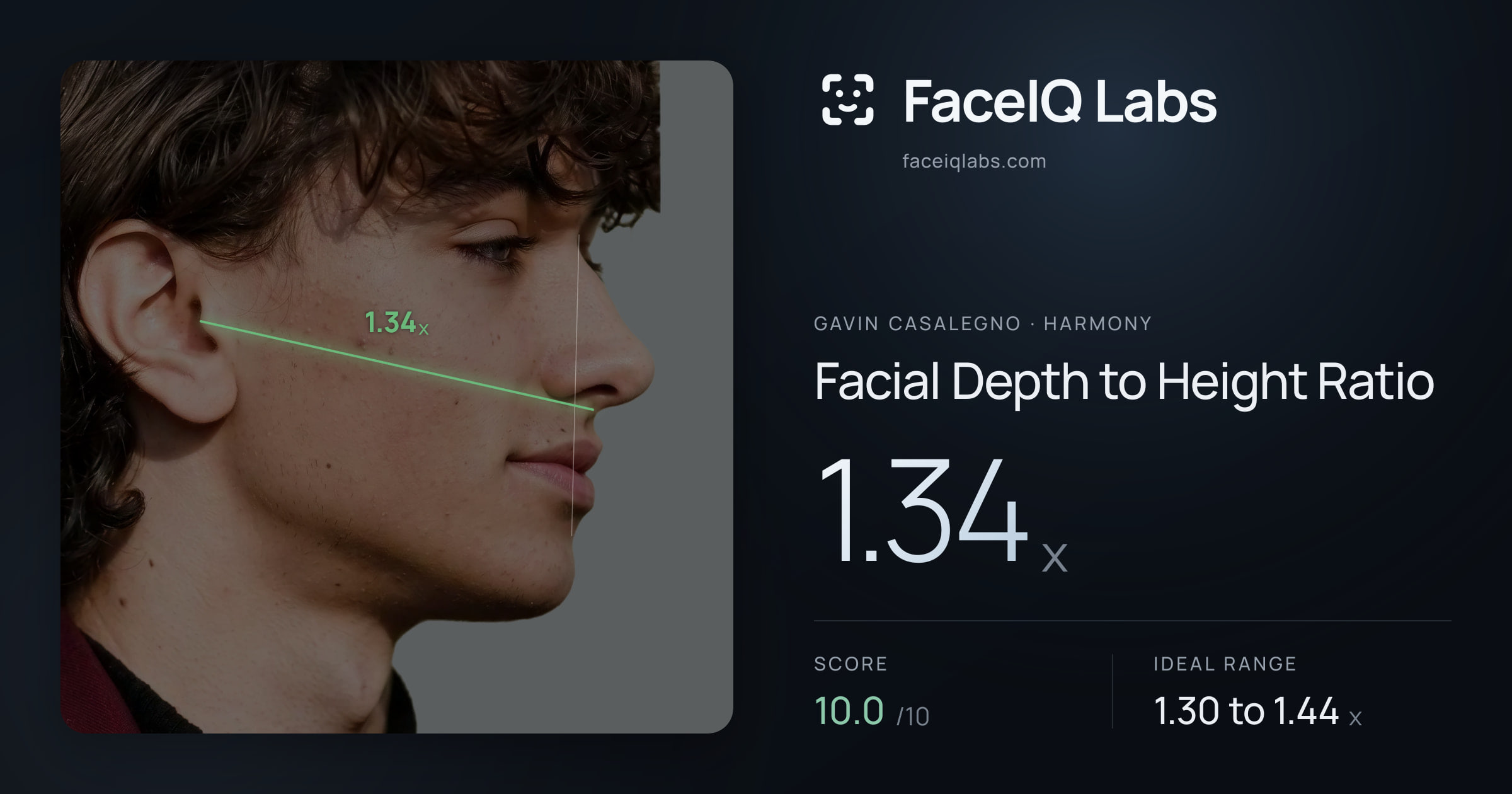 Gavin Casalegno Facial Depth to Height Ratio: 1.34x, drawn on the photo