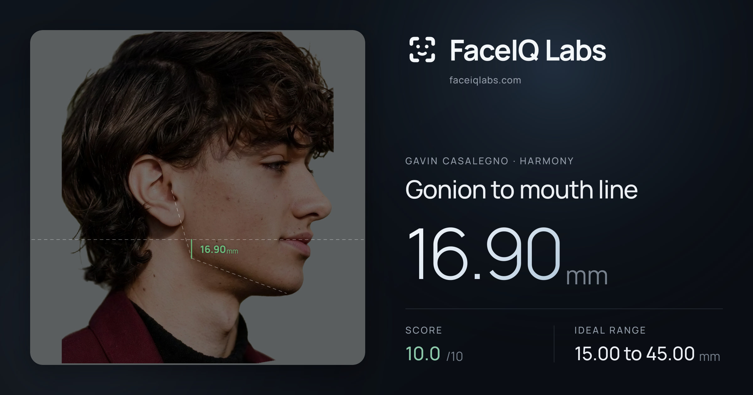 Gavin Casalegno Gonion to mouth line: 16.90mm, drawn on the photo
