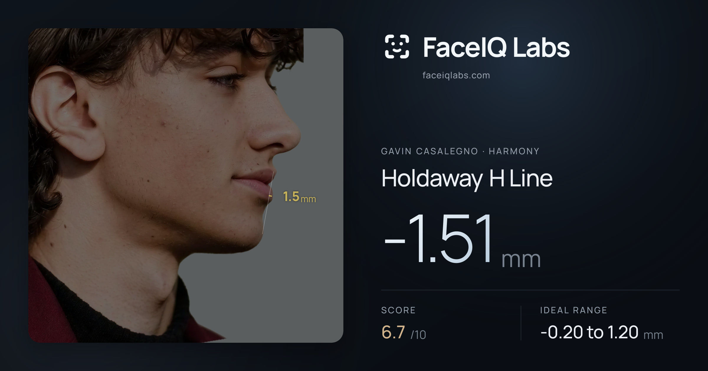 Gavin Casalegno Holdaway H Line: -1.51mm, drawn on the photo