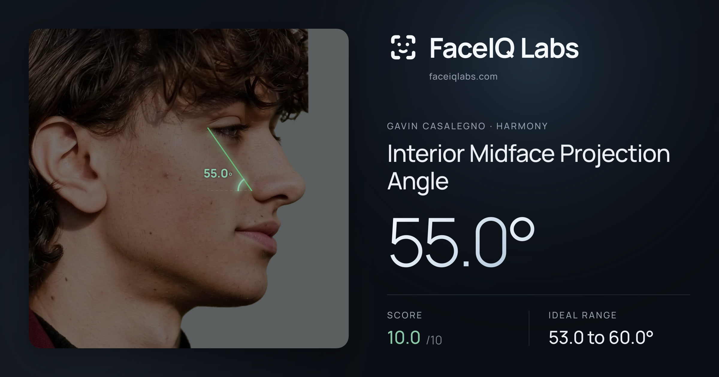 Gavin Casalegno Interior Midface Projection Angle: 55.0°, drawn on the photo
