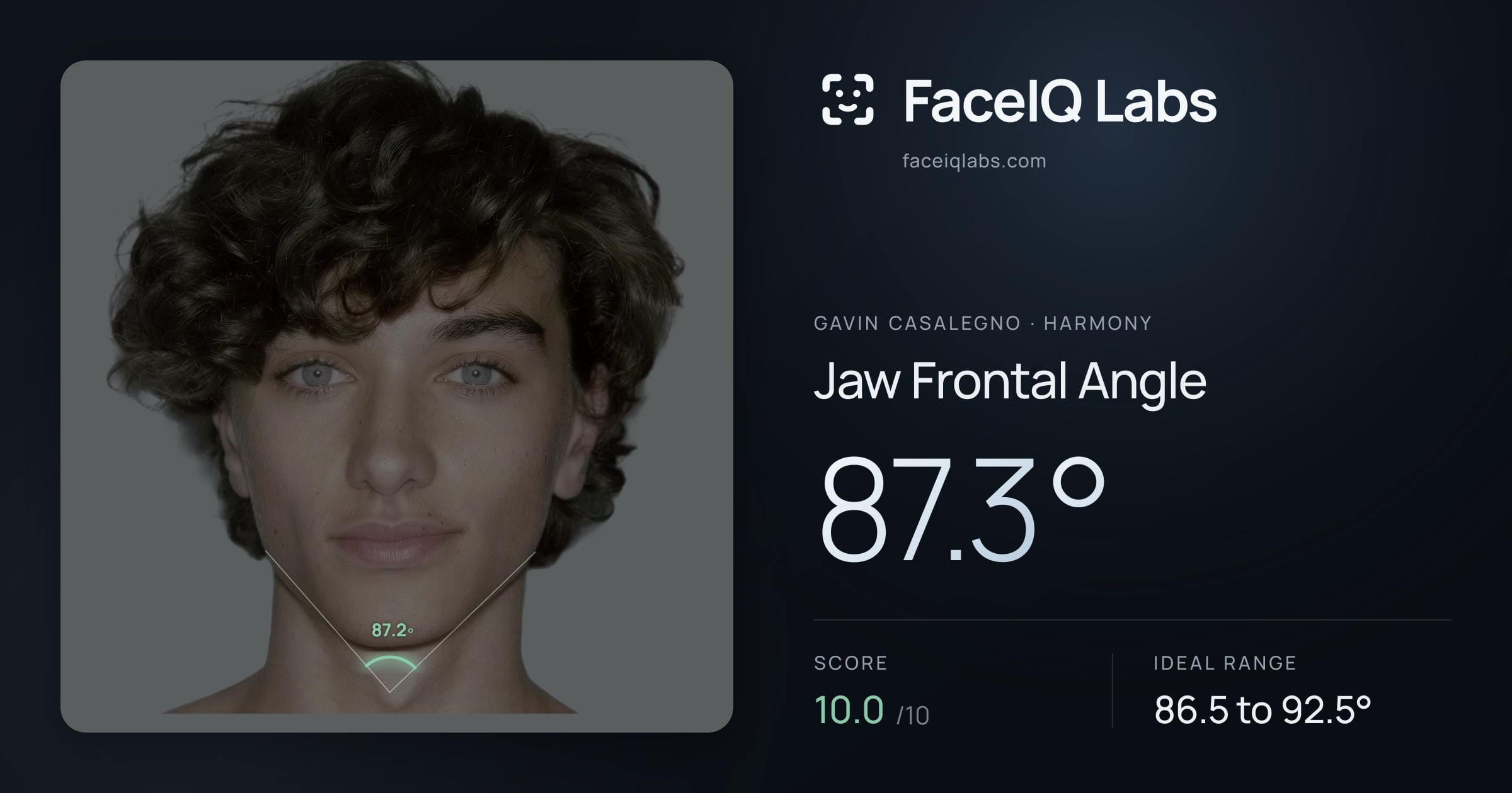 Gavin Casalegno Jaw Frontal Angle: 87.3°, drawn on the photo