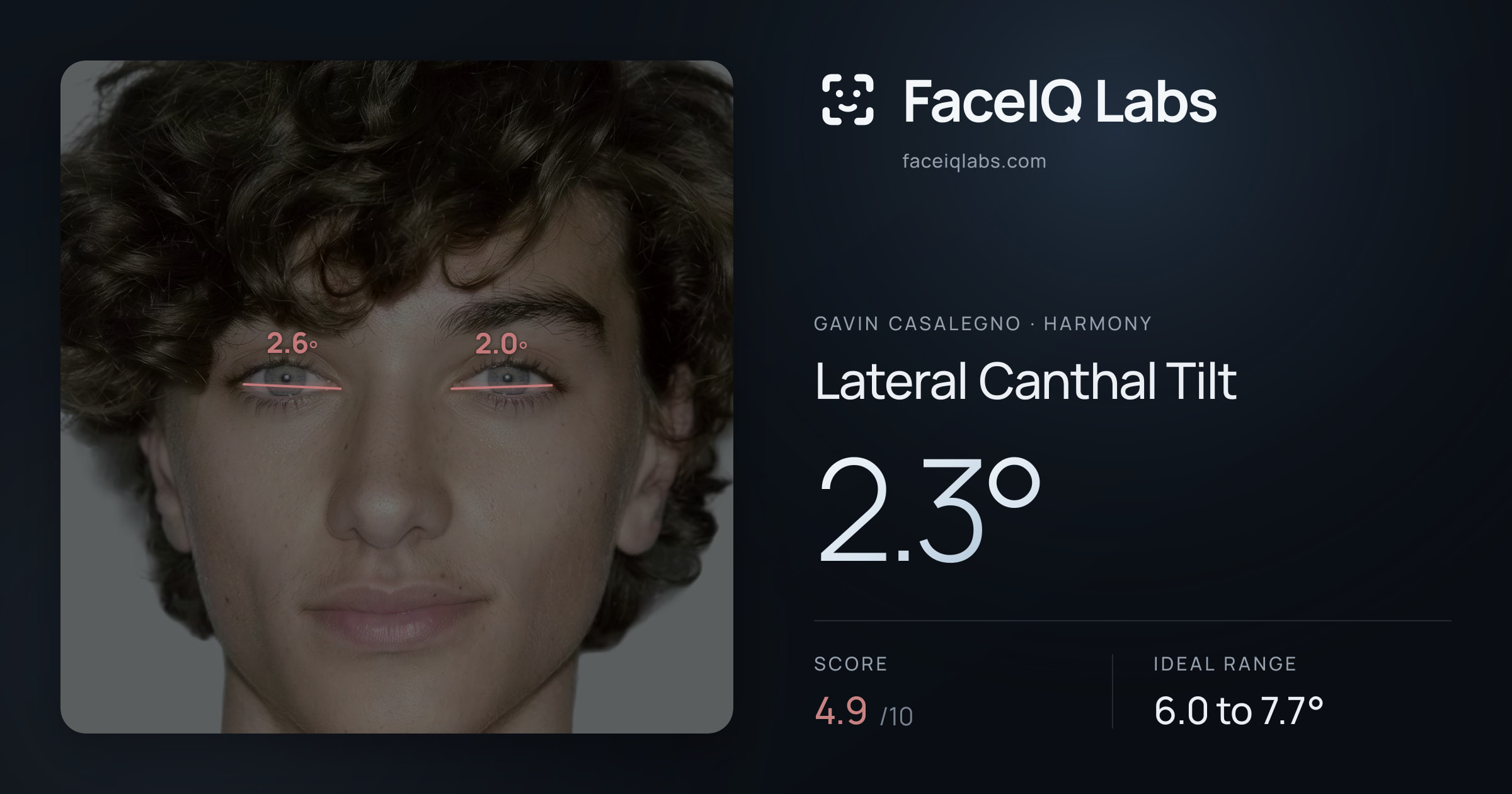 Gavin Casalegno Lateral Canthal Tilt: 2.3°, drawn on the photo