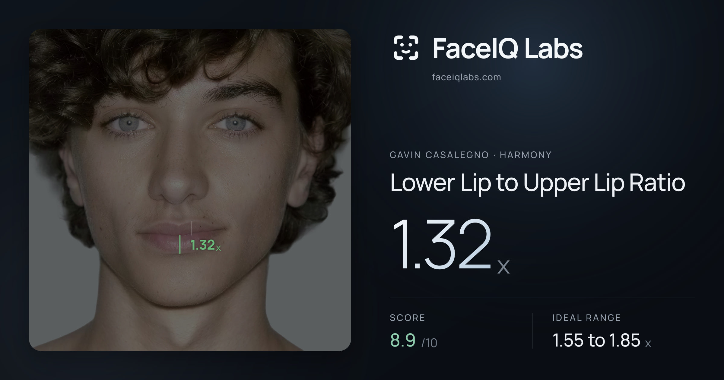 Gavin Casalegno Lower Lip to Upper Lip Ratio: 1.32x, drawn on the photo