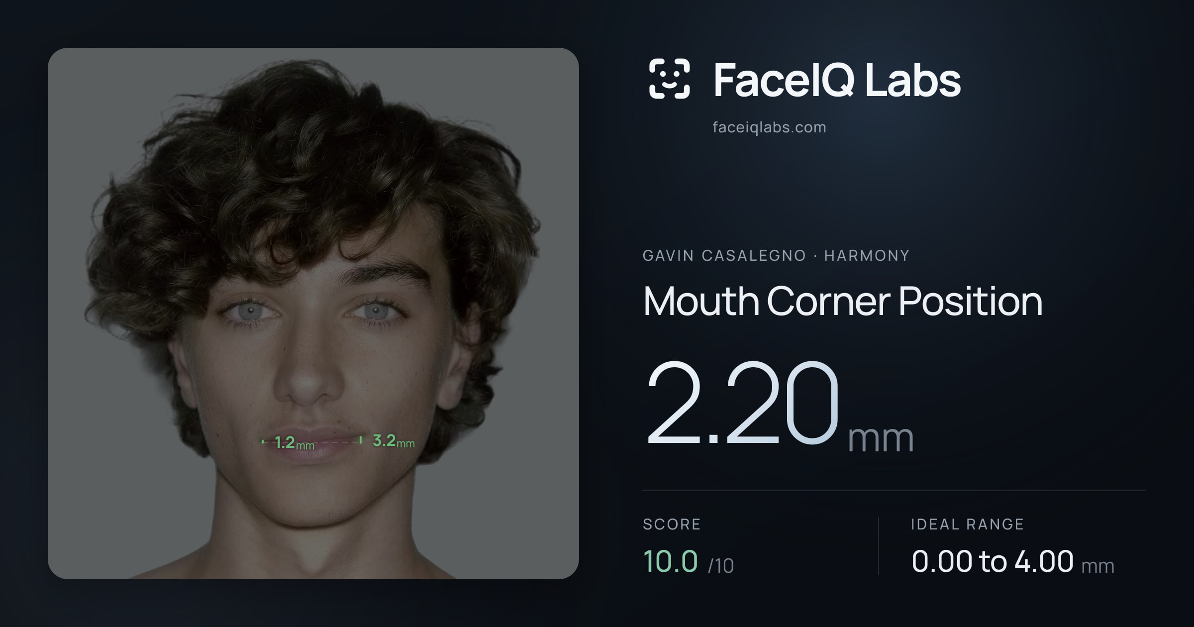 Gavin Casalegno Mouth Corner Position: 2.20mm, drawn on the photo