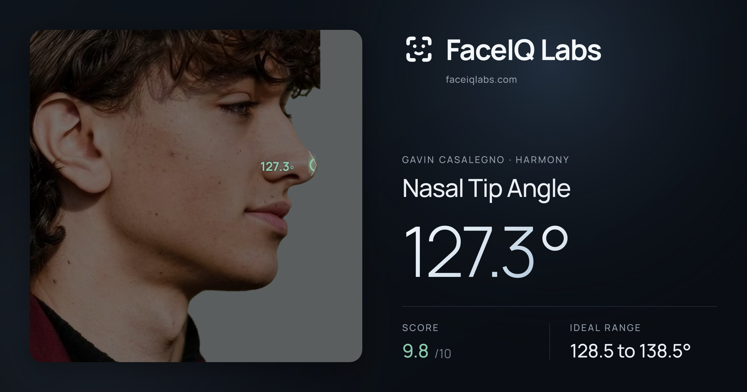 Gavin Casalegno Nasal Tip Angle: 127.3°, drawn on the photo