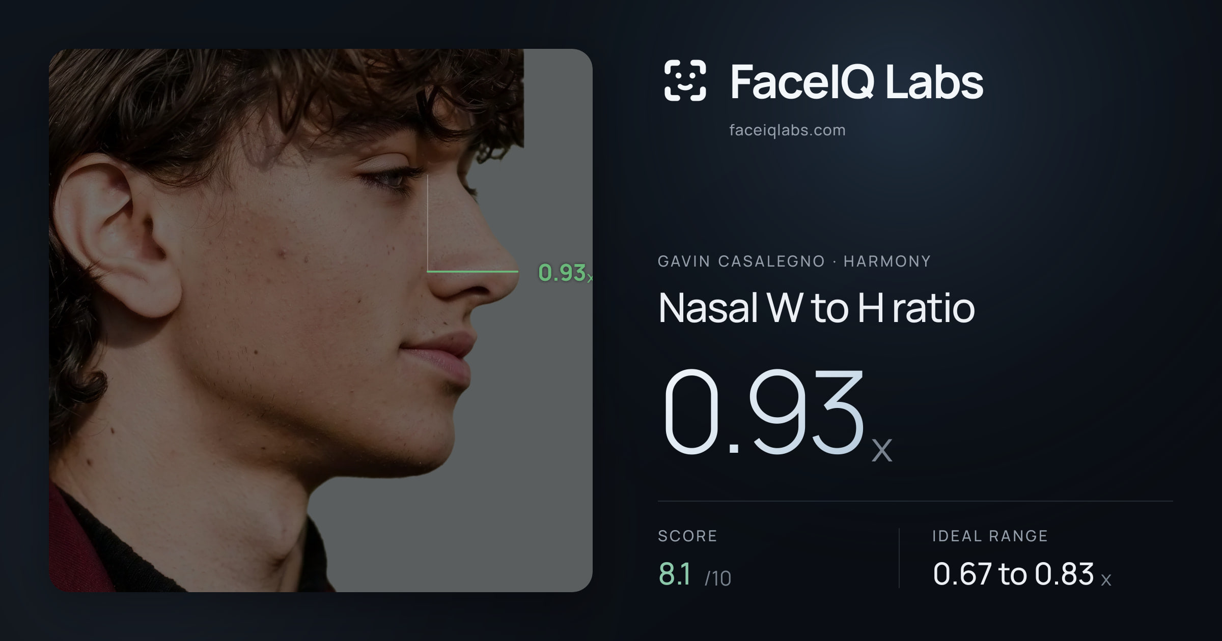 Gavin Casalegno Nasal W to H ratio: 0.93x, drawn on the photo