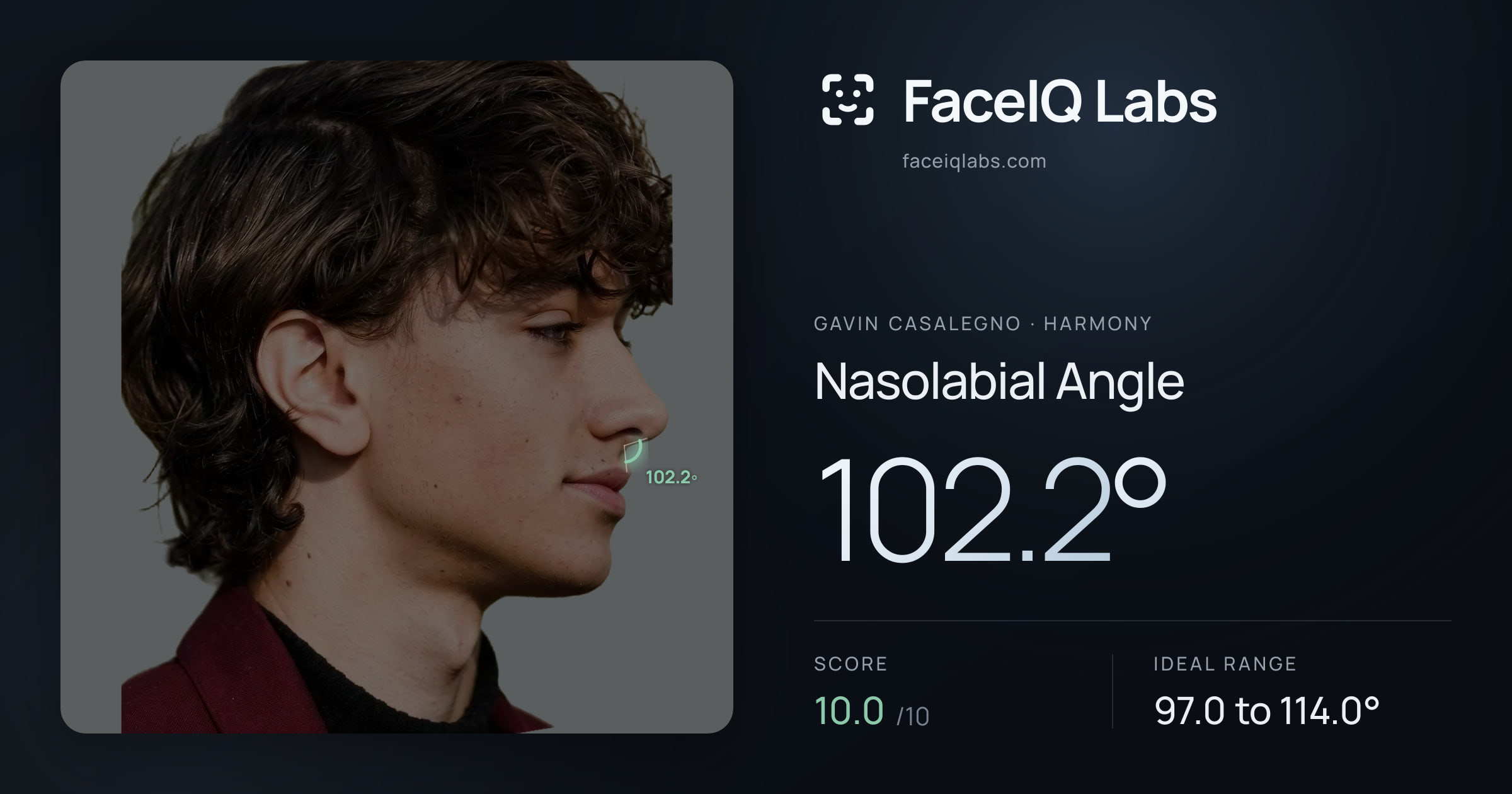 Gavin Casalegno Nasolabial Angle: 102.2°, drawn on the photo