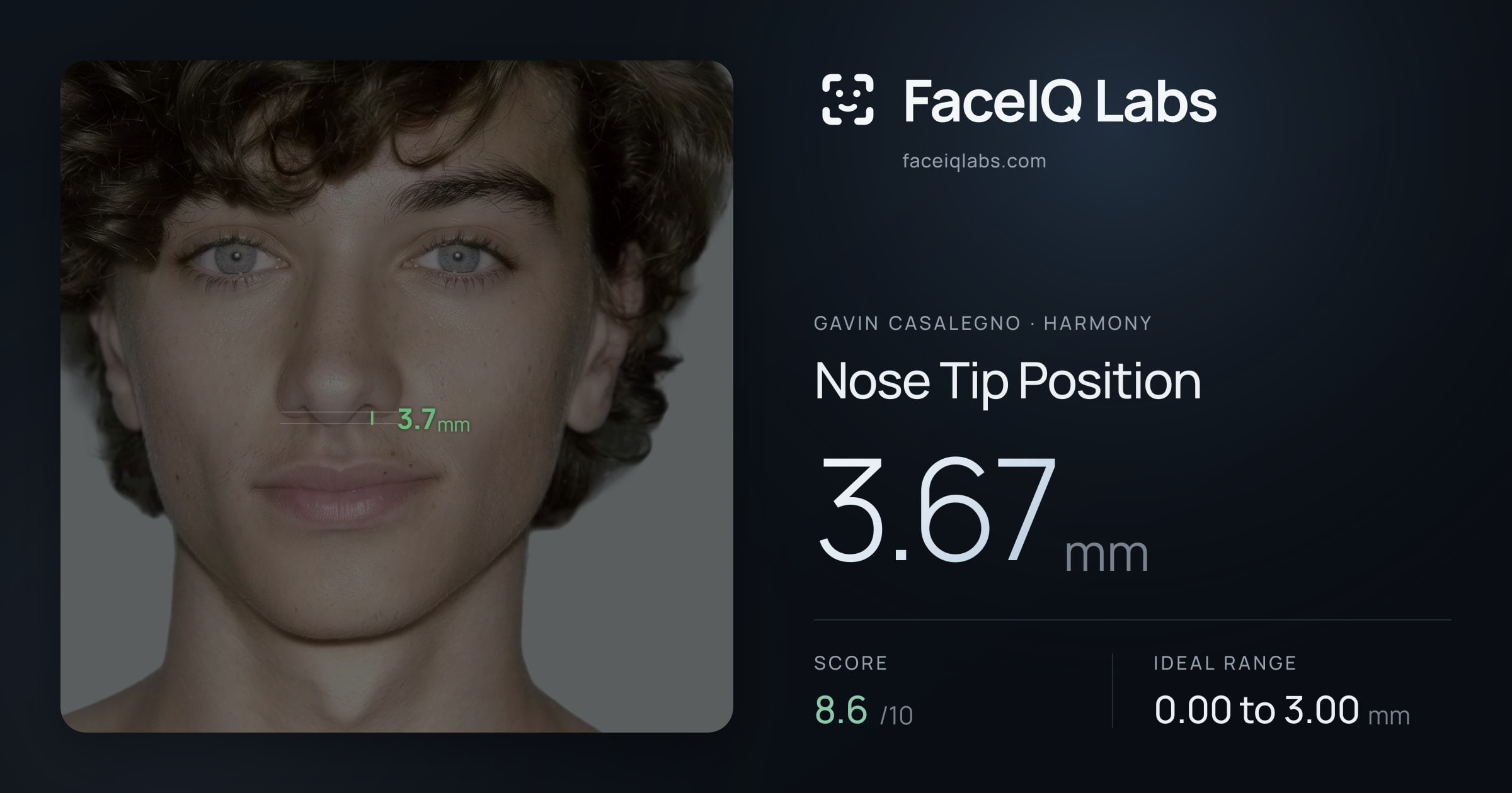 Gavin Casalegno Nose Tip Position: 3.67mm, drawn on the photo